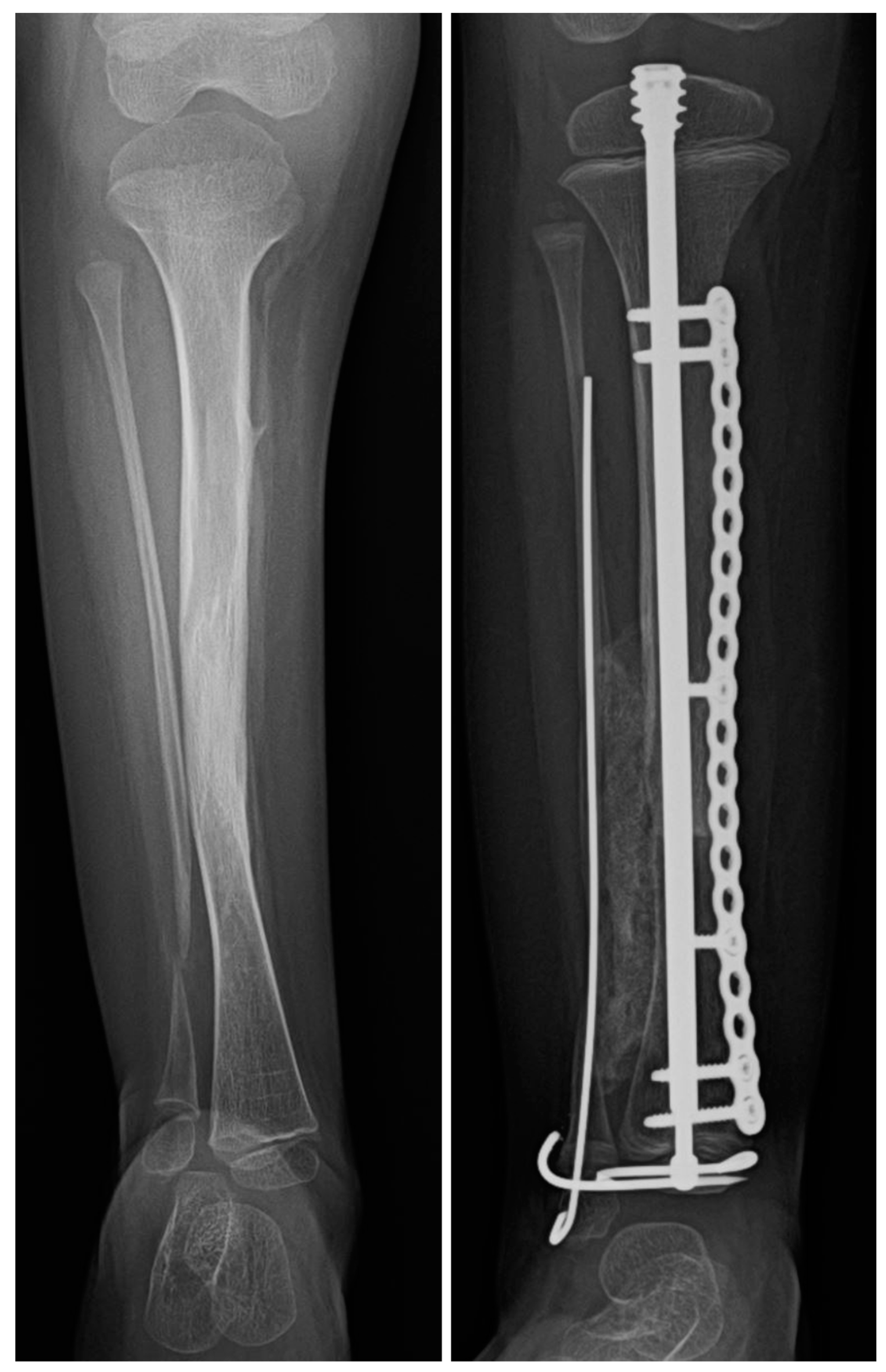 Children 08 00547 g008