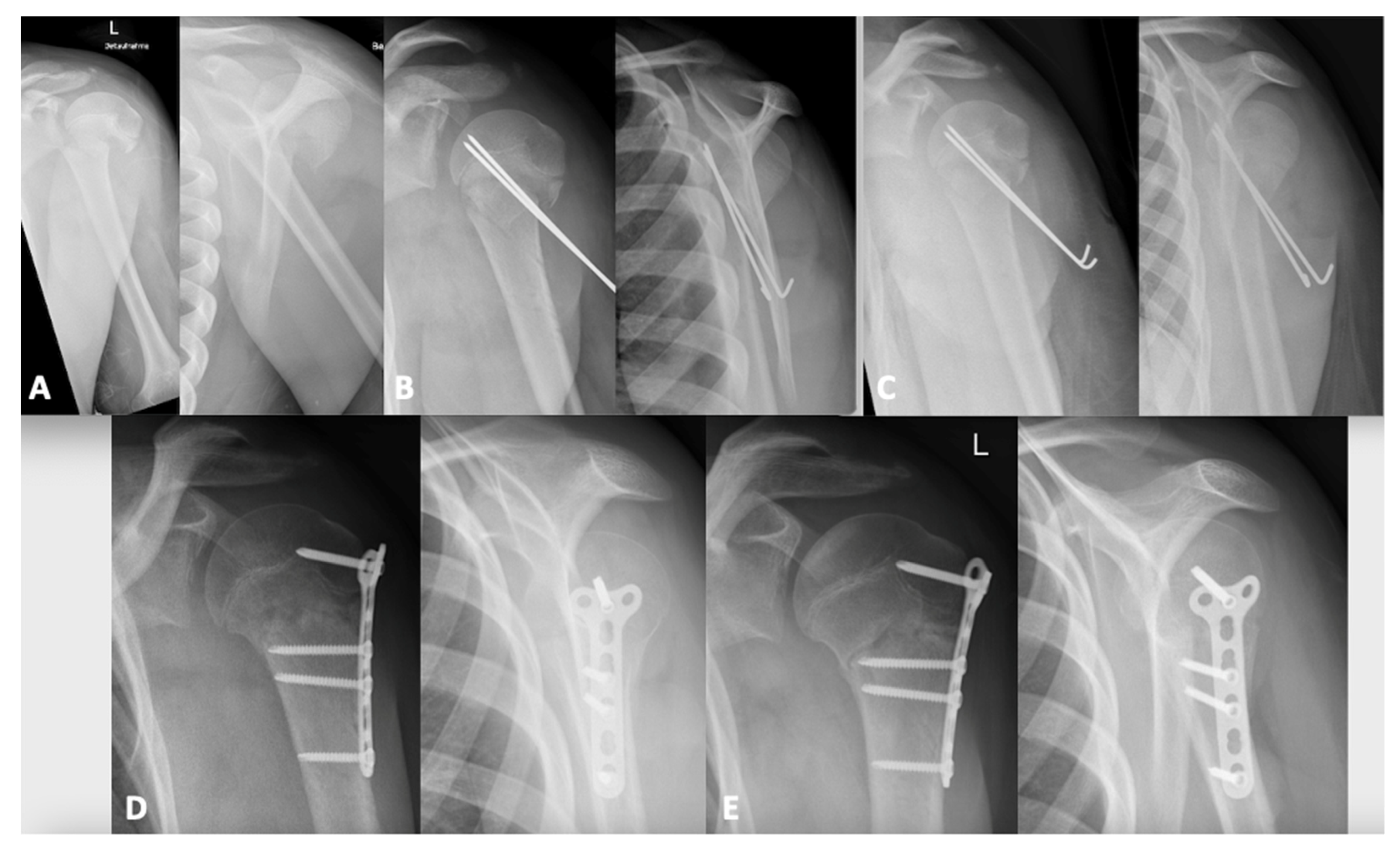 Children 08 00635 g002 550