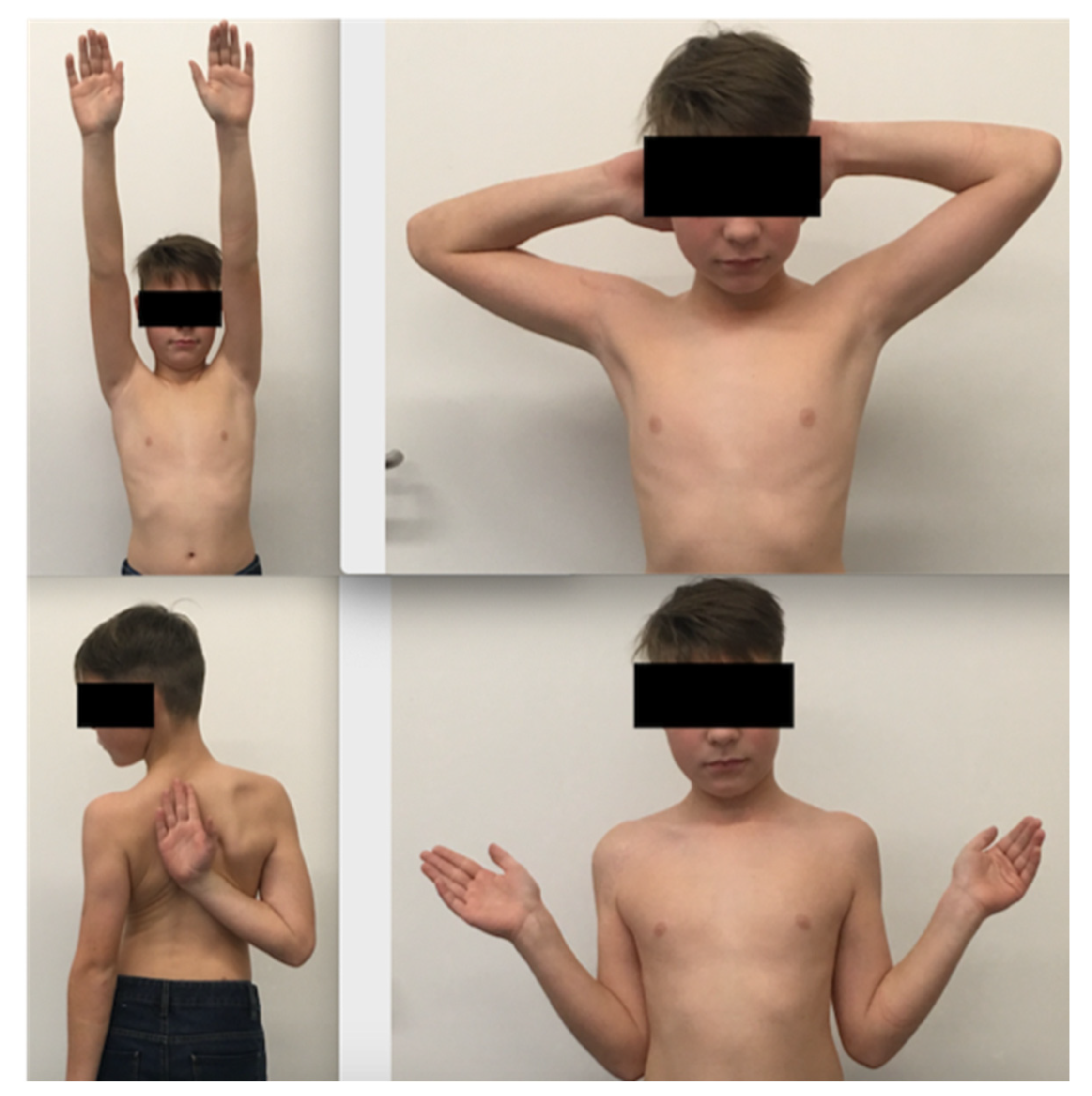 Children 08 00635 g005 550