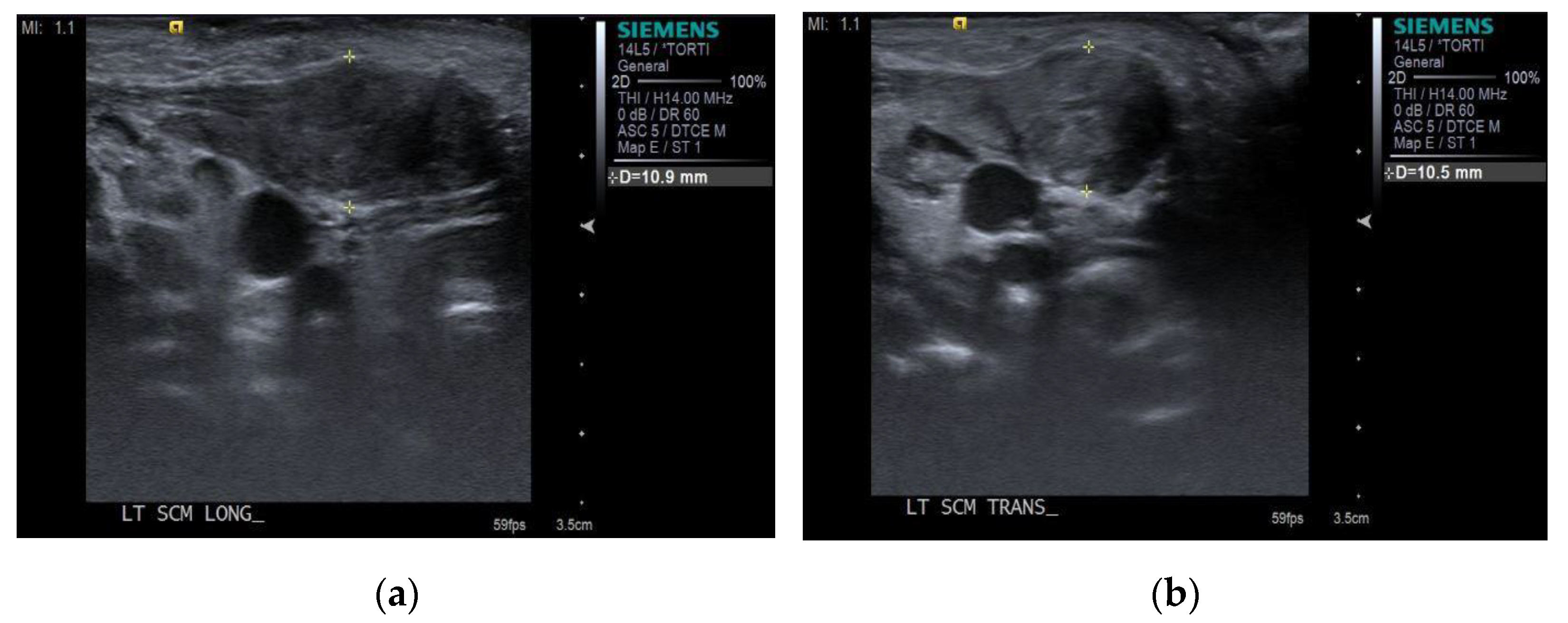 Children 08 00735 g002