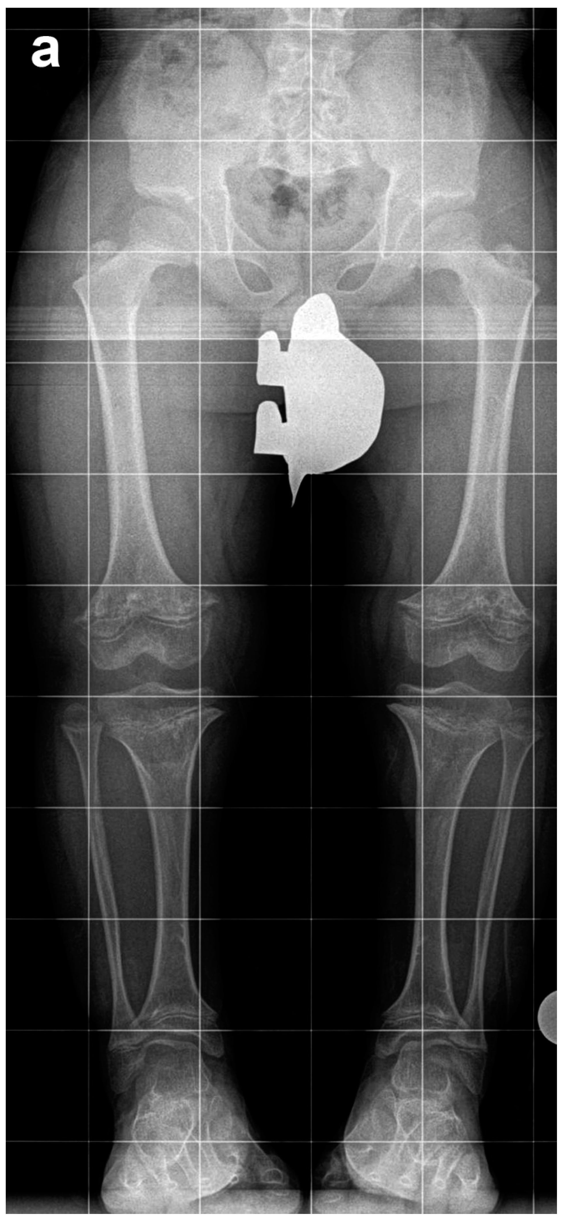 Children 08 00749 g002a