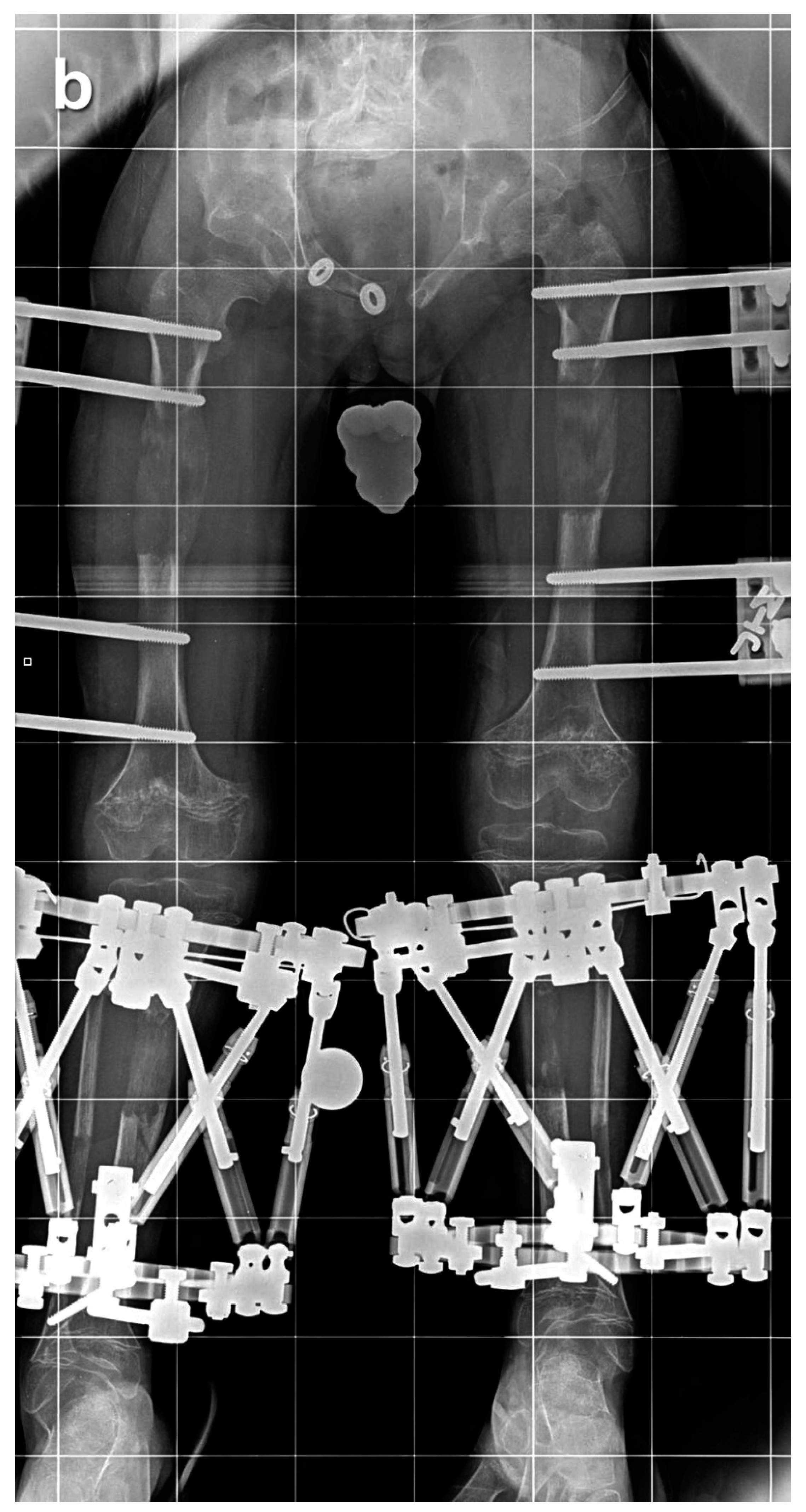 Children 08 00749 g002b