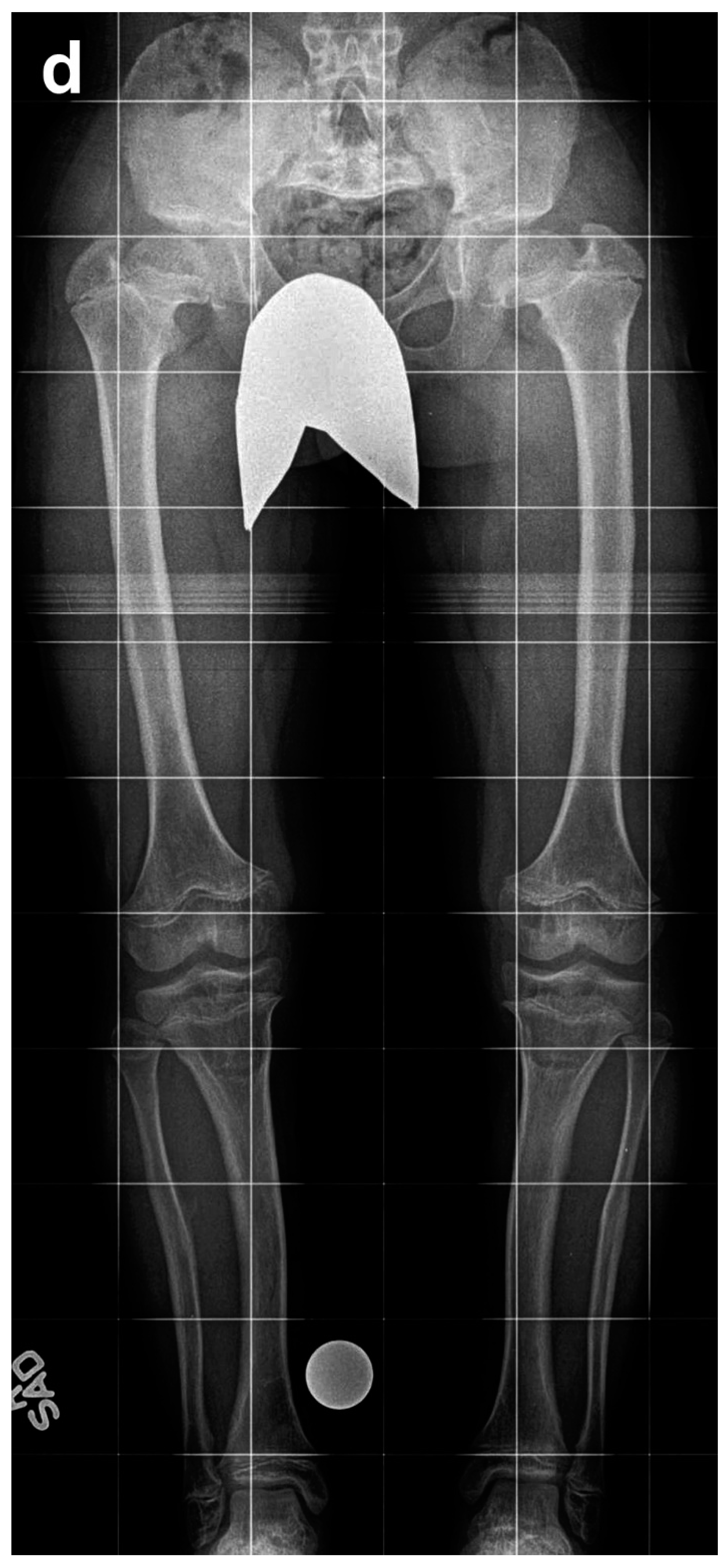 Children 08 00749 g002d