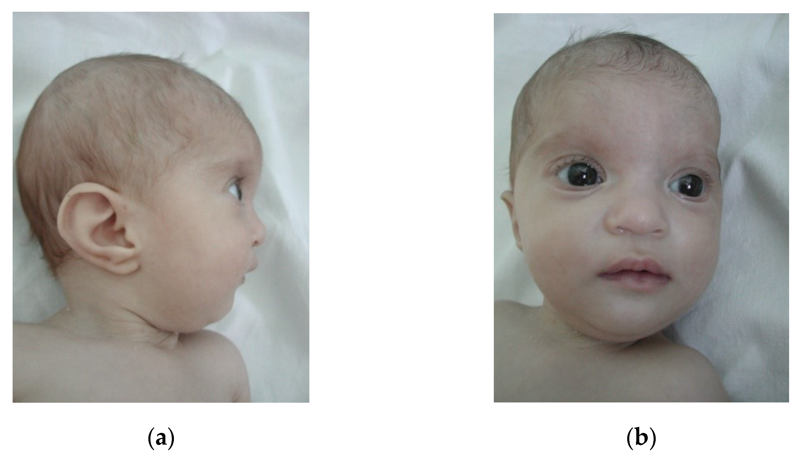 Children 08 00751 g005