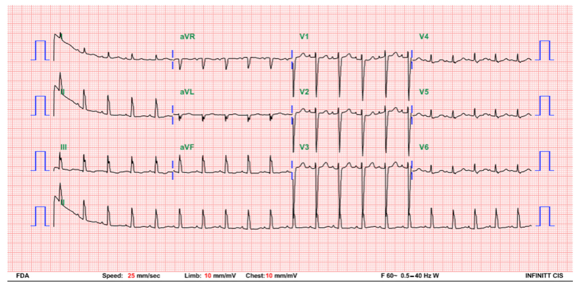 Children 08 00790 g003 550