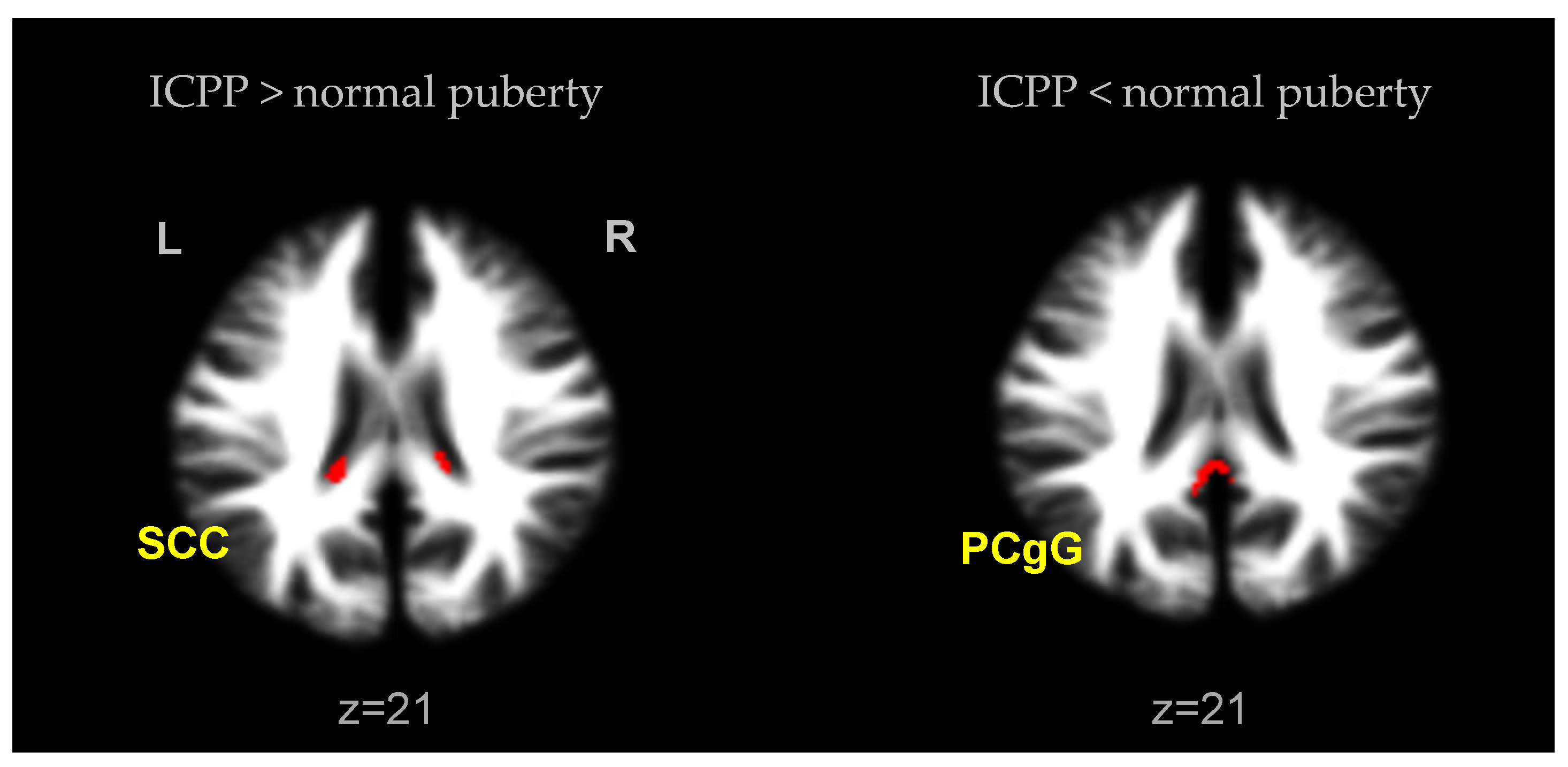 Children 08 00797 g002 Children 08 00797 g002