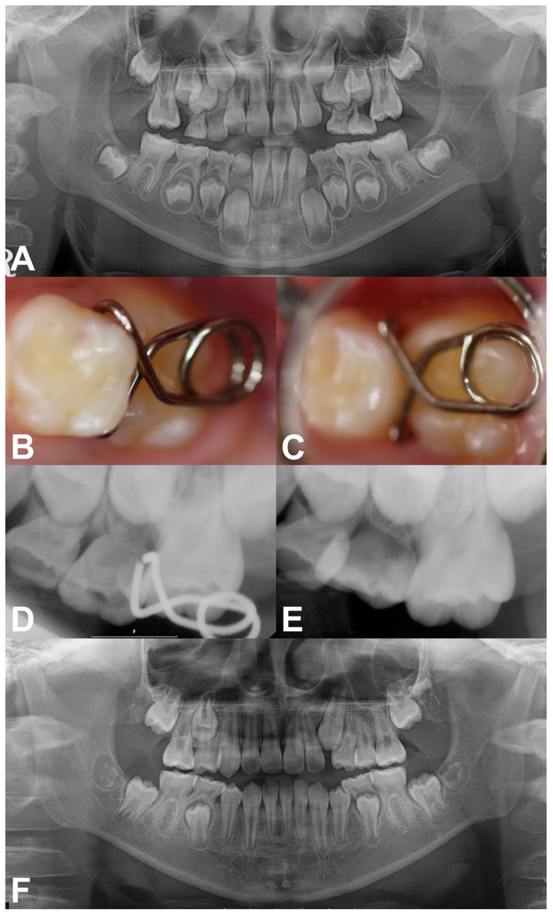 Children 08 00823 g002