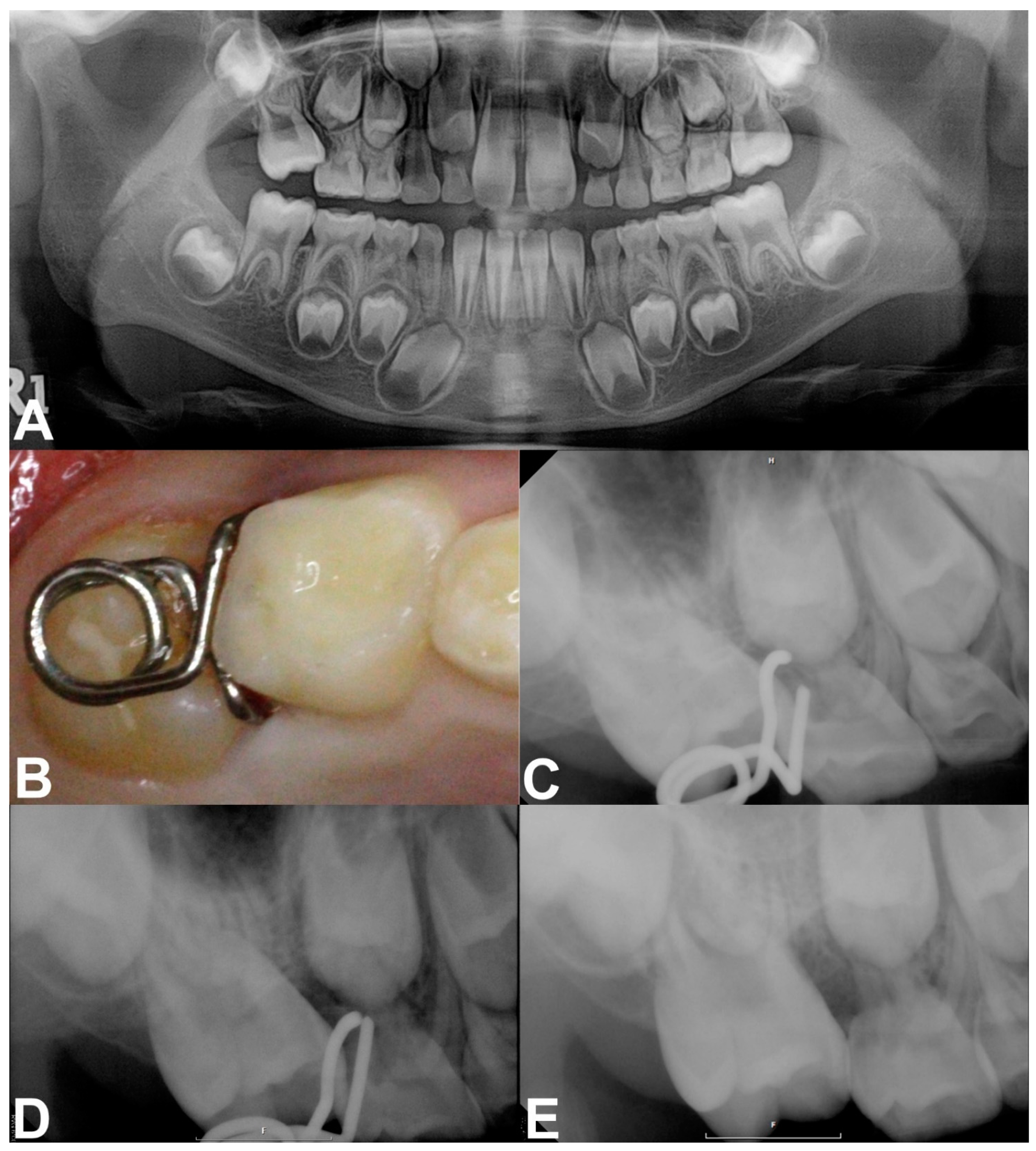 Children 08 00823 g003