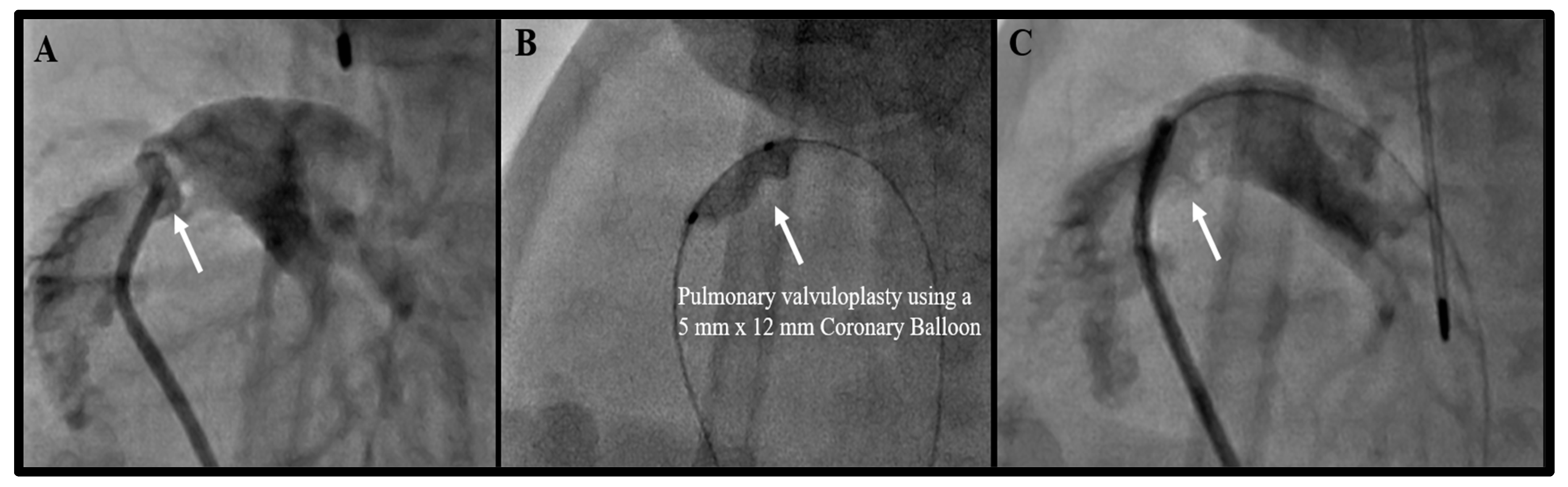 Children 08 00826 g001 Children 08 00826 g001