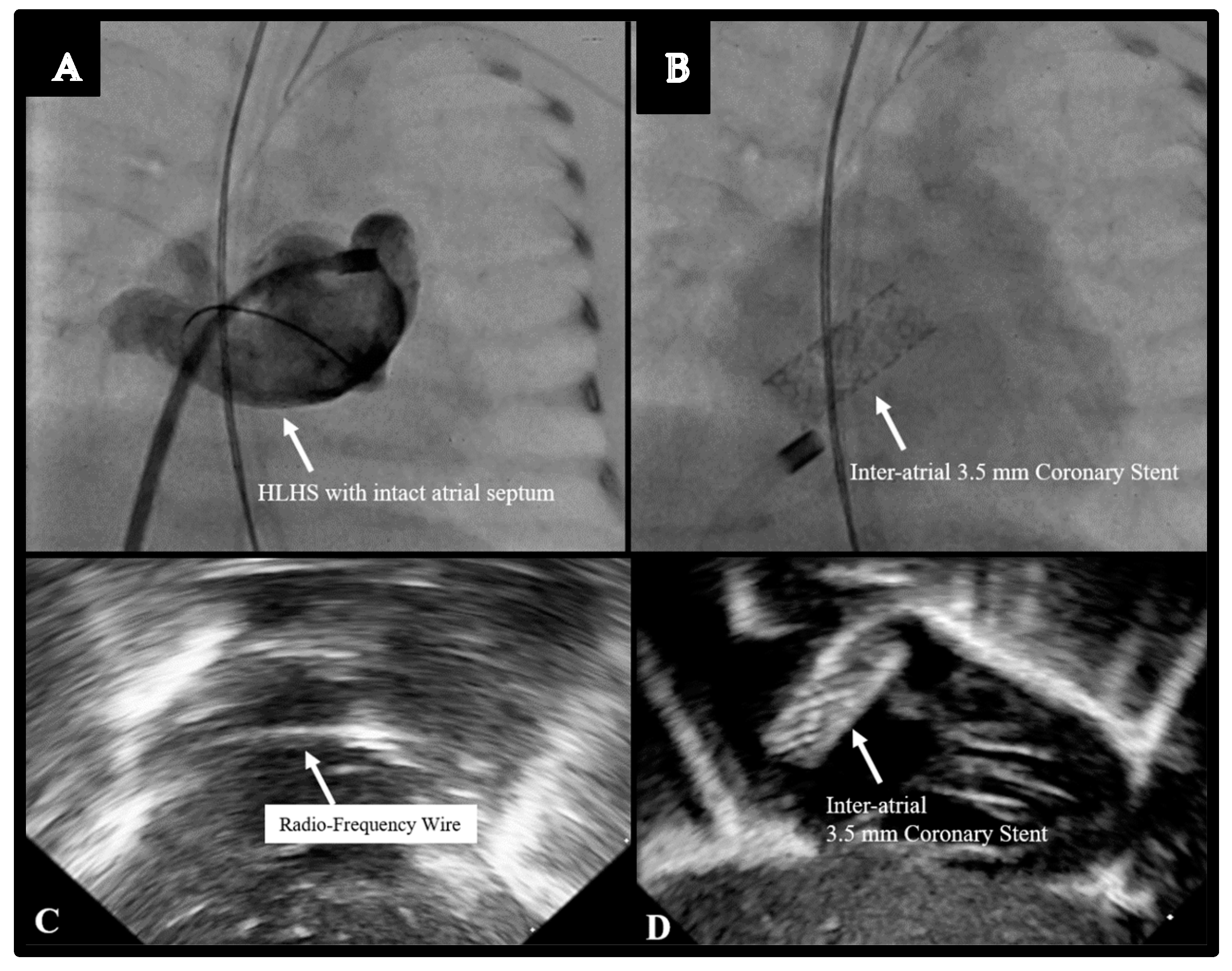 Children 08 00826 g004 Children 08 00826 g004