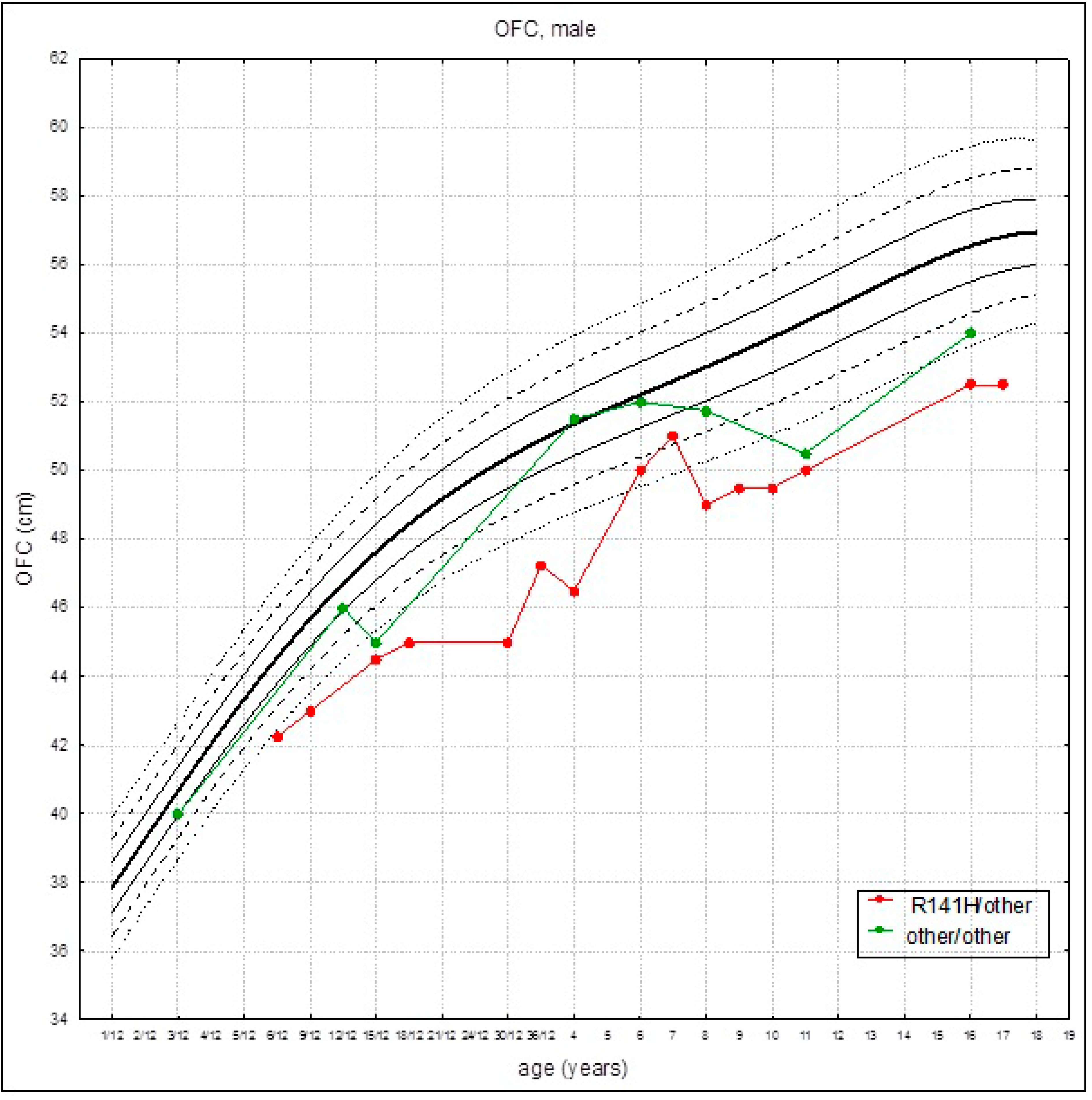 Anthropometric Phenotype of Patients with PMM2-CDG