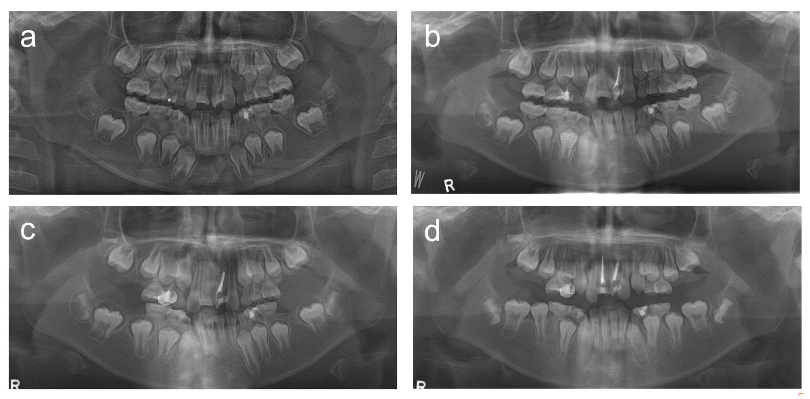 Children 08 00904 g001a