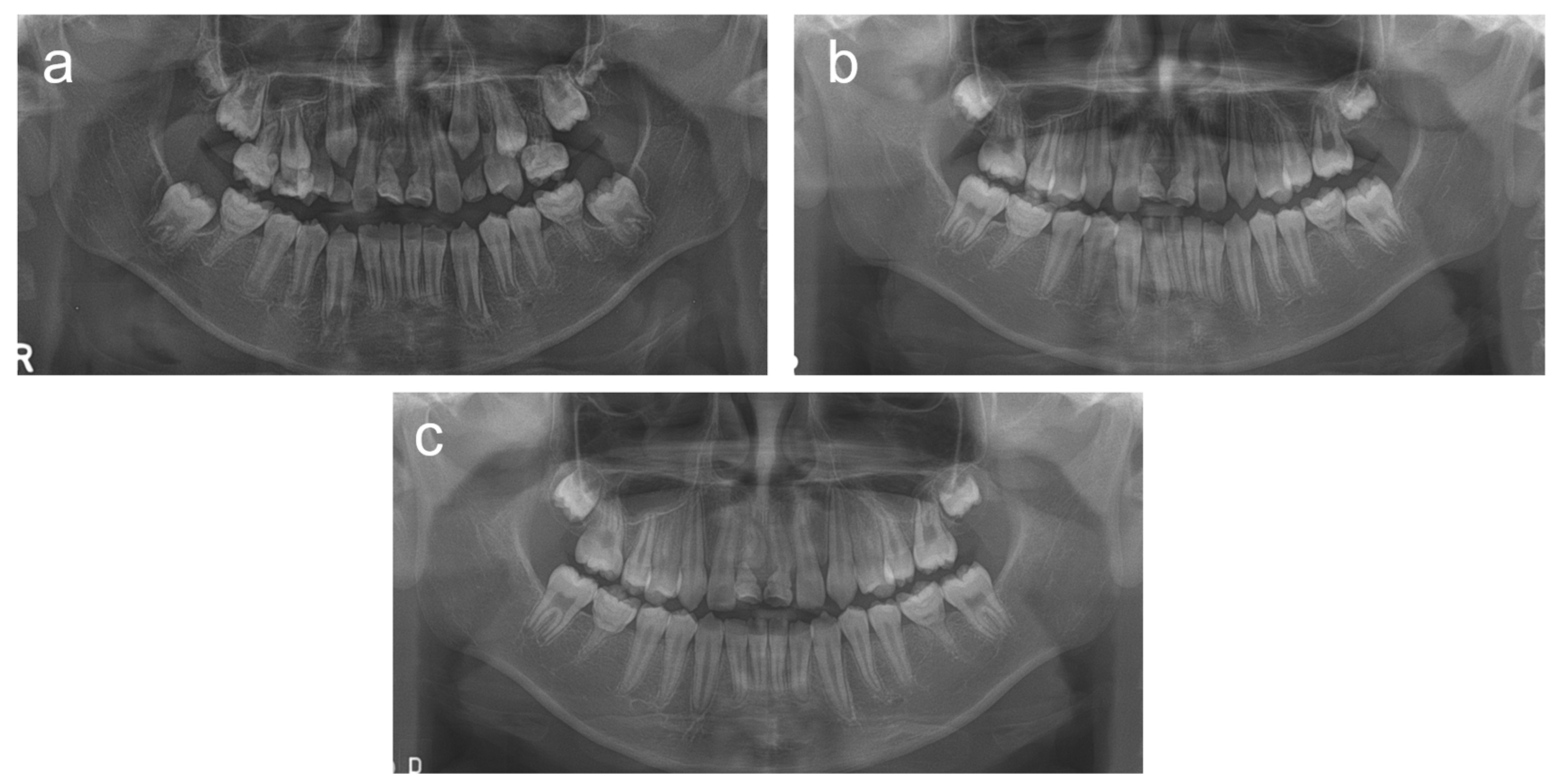 Children 08 00904 g003