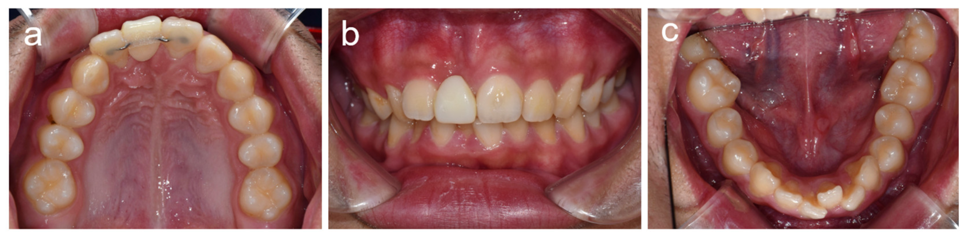 Children 08 00904 g005