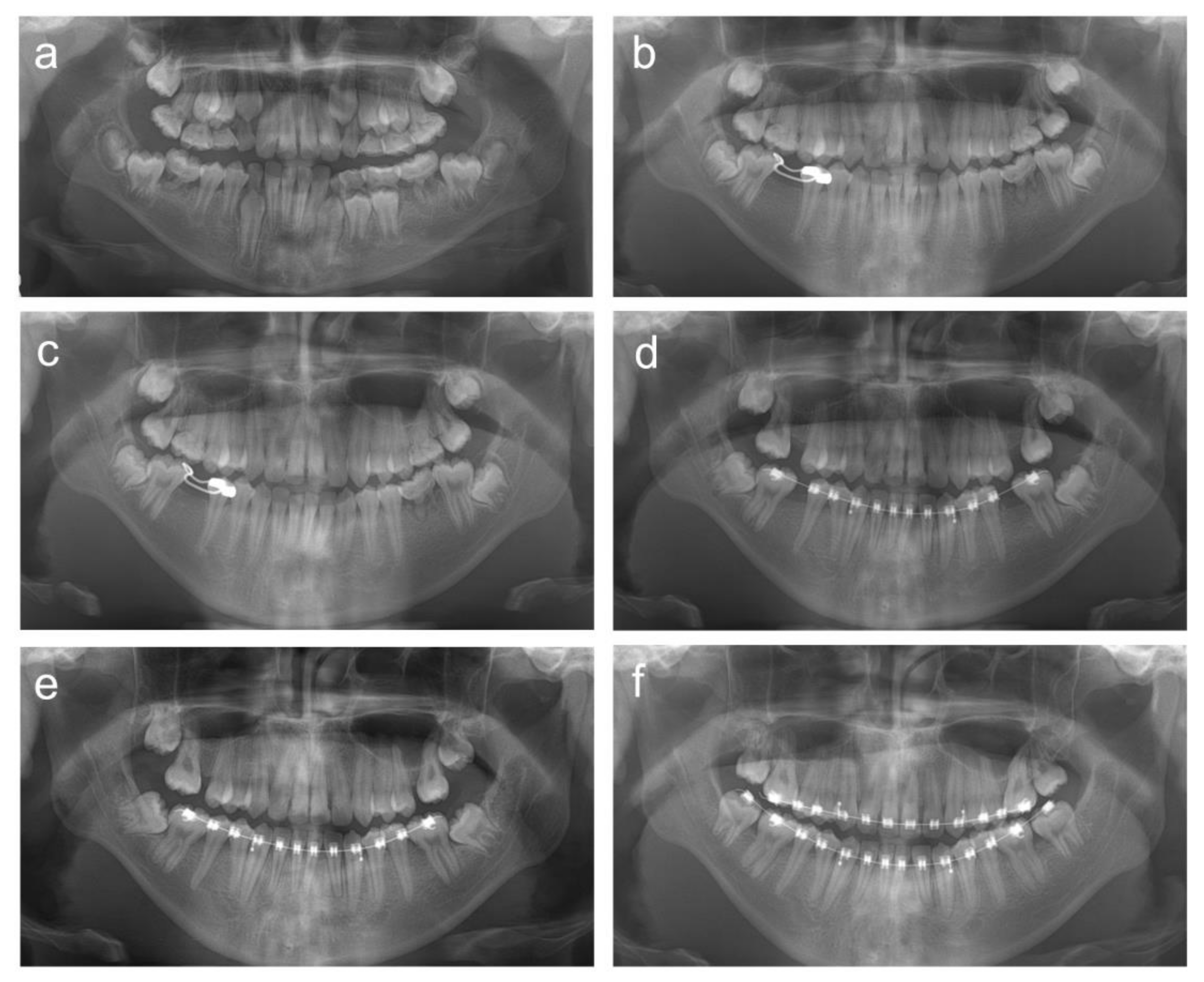 Children 08 00904 g006