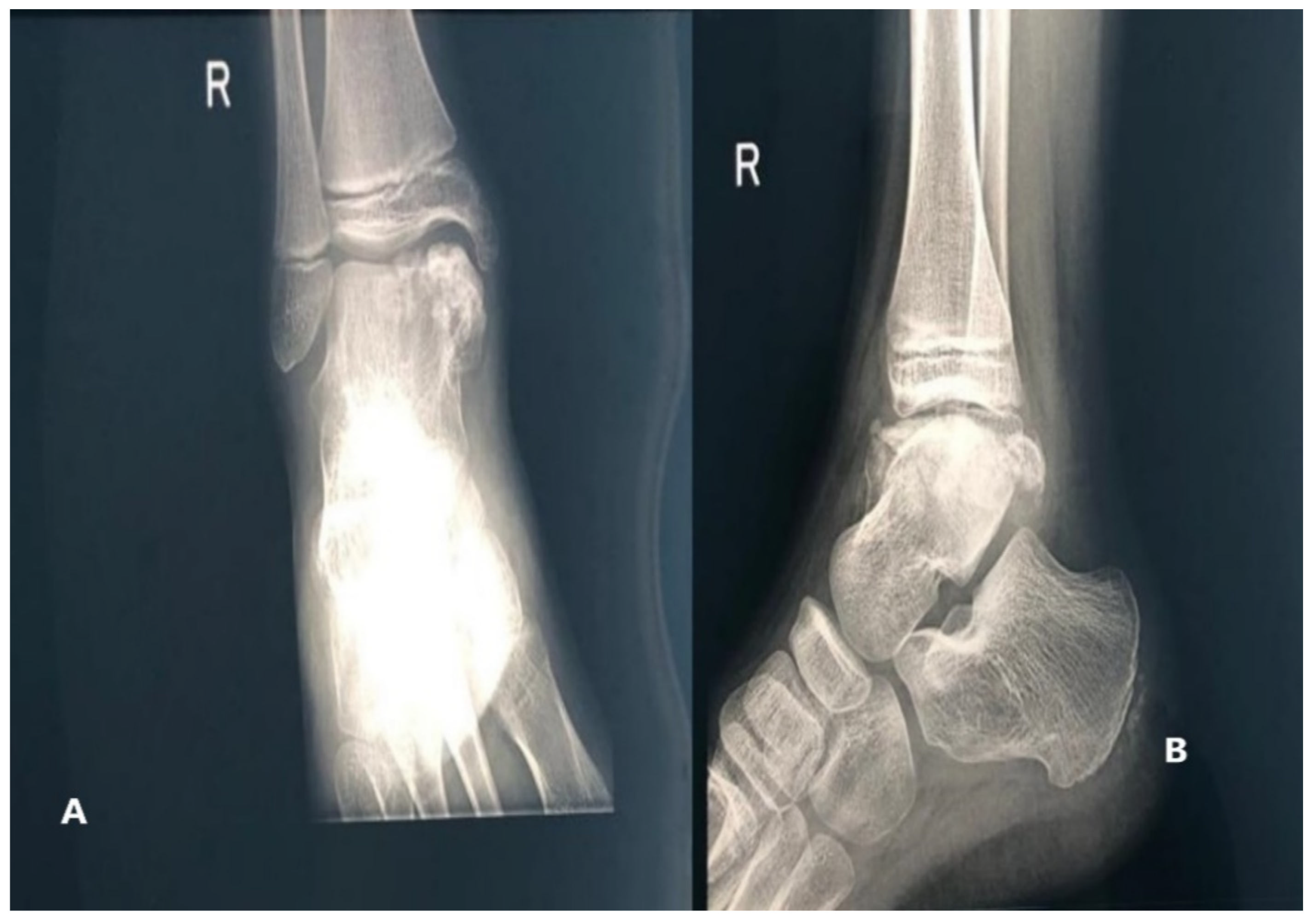 Children 08 00907 g002