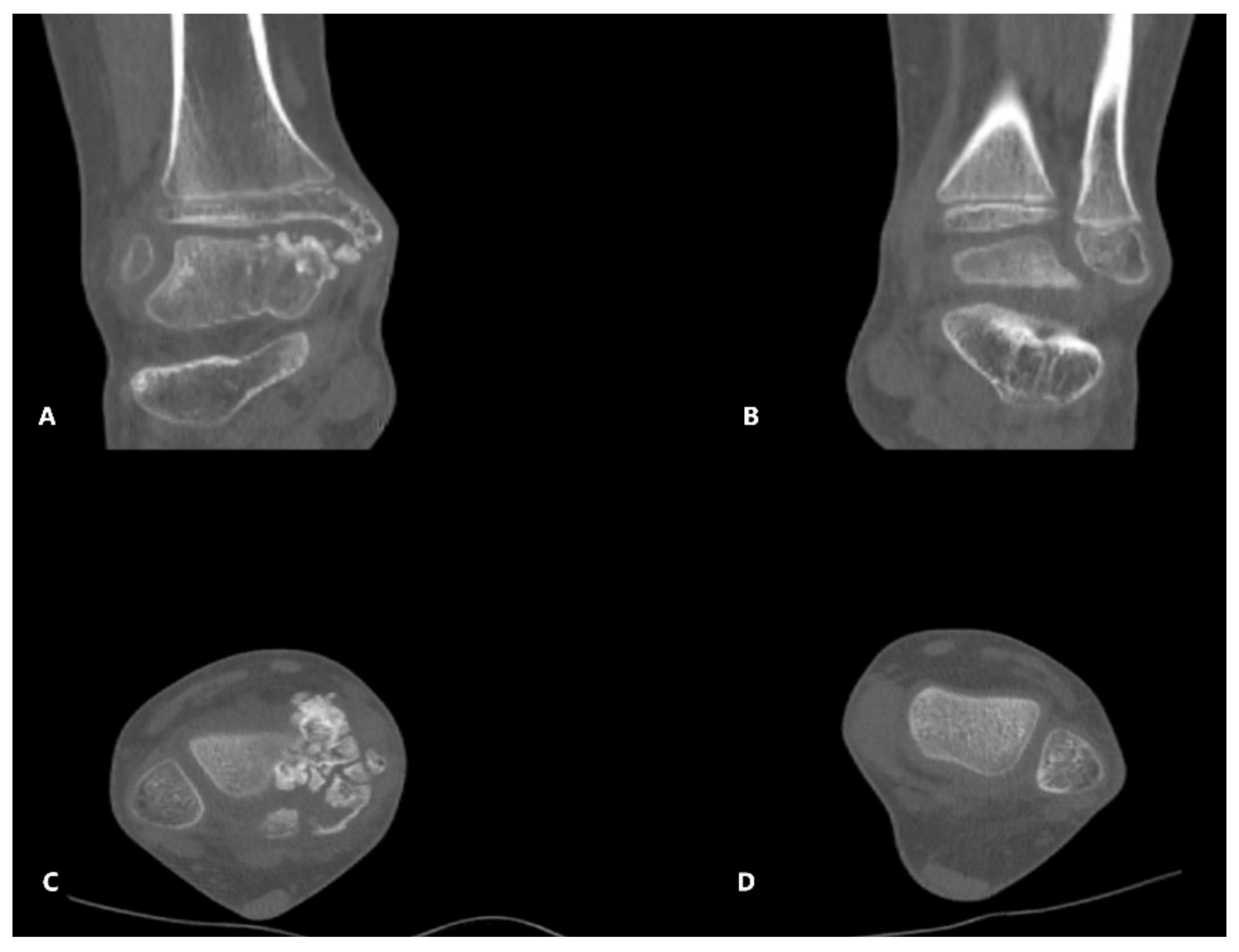 Children 08 00907 g003