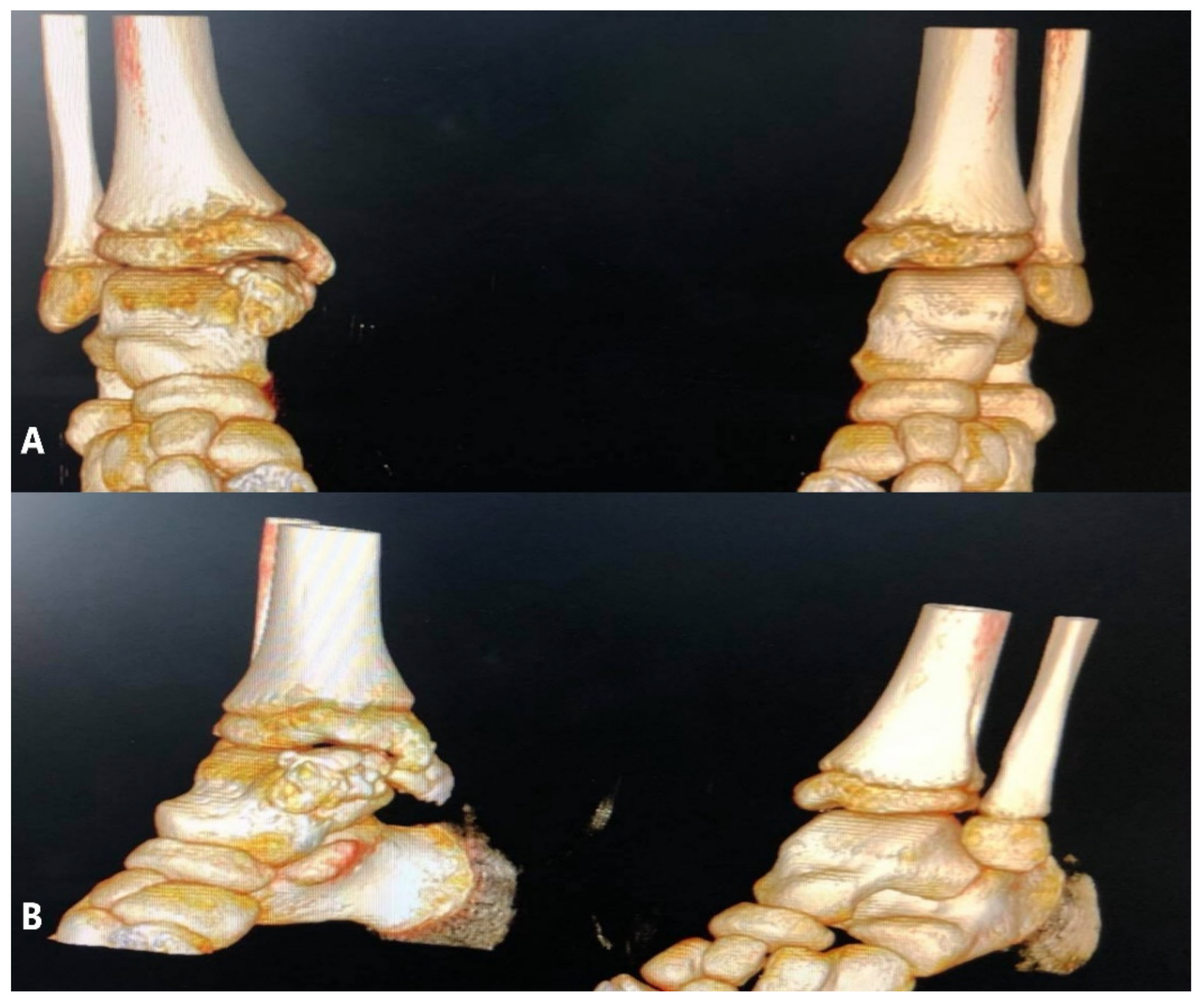 Children 08 00907 g004