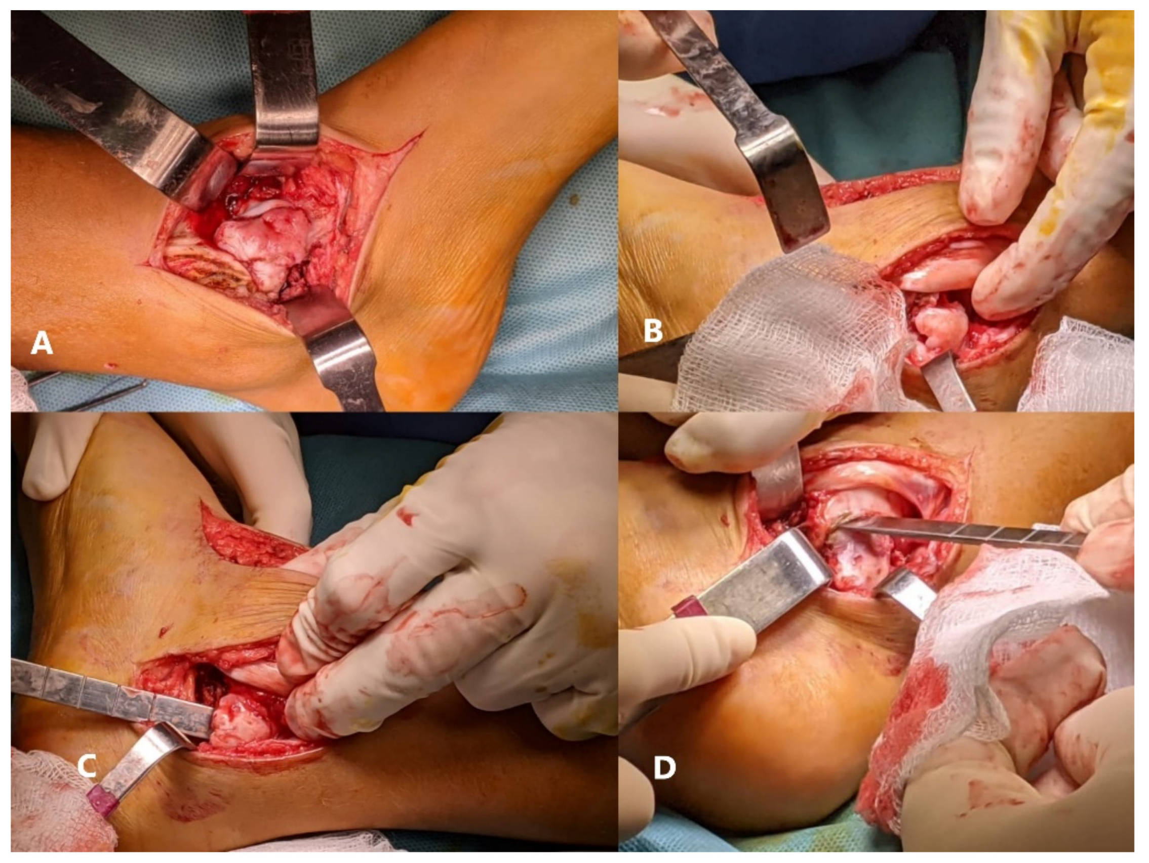 Children 08 00907 g006