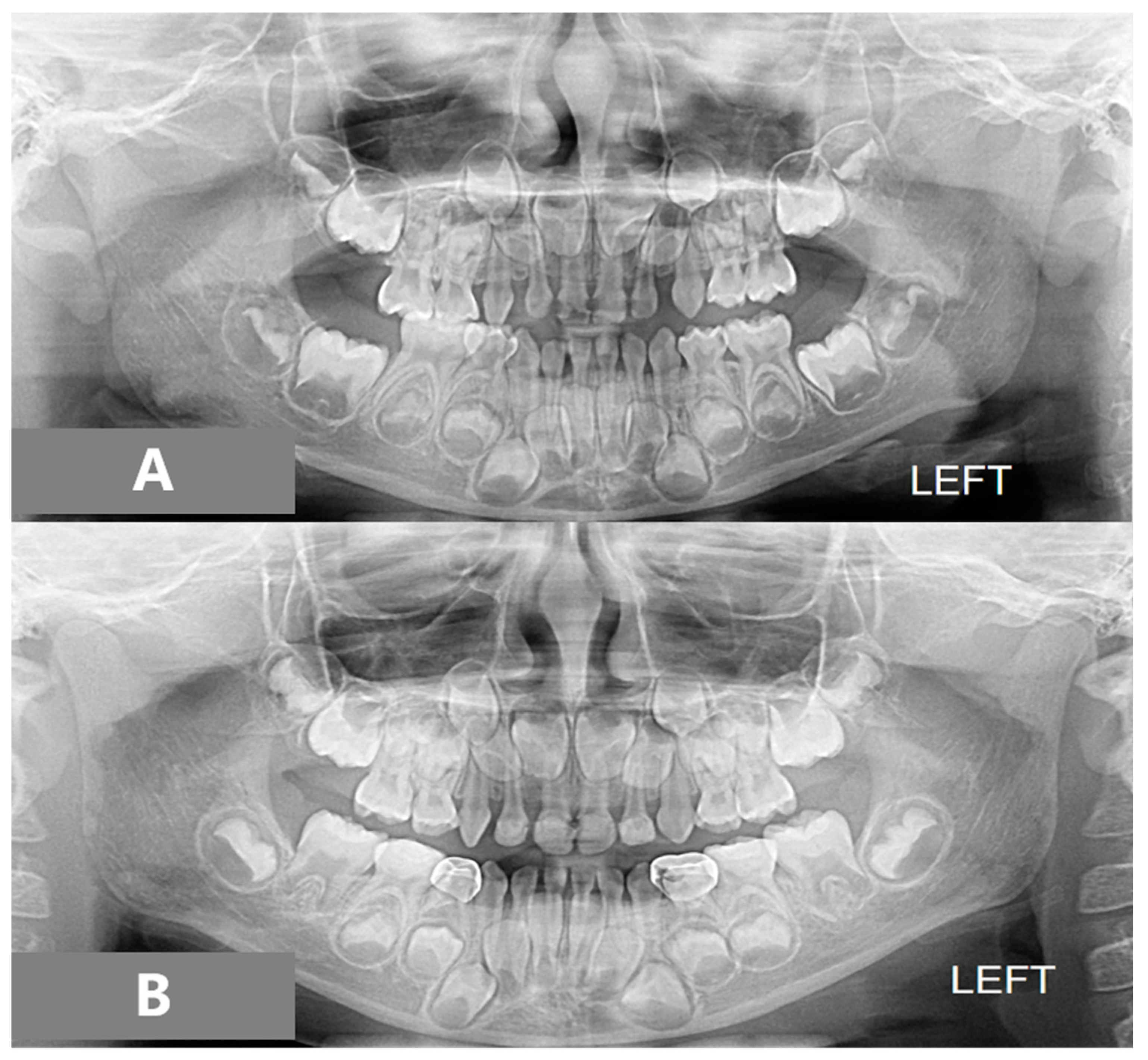 Children 08 00957 g004