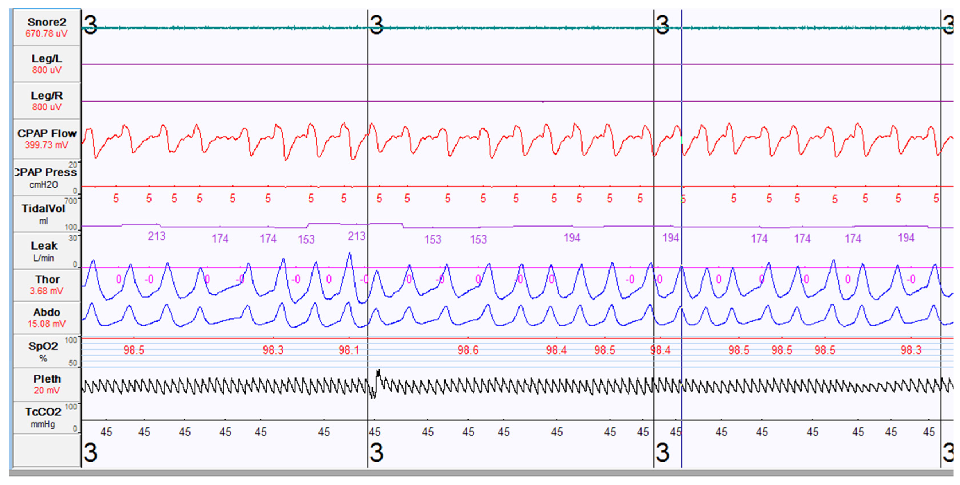 Children 08 00979 g003 Children 08 00979 g003