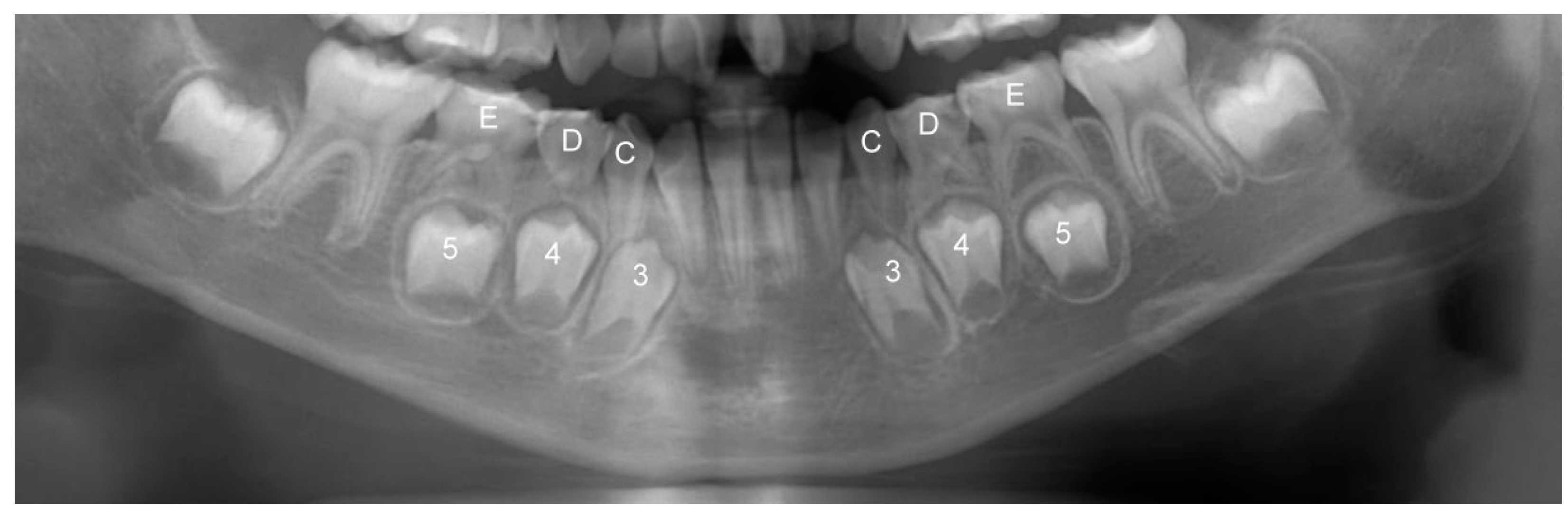 Children 08 00999 g001 Children 08 00999 g001