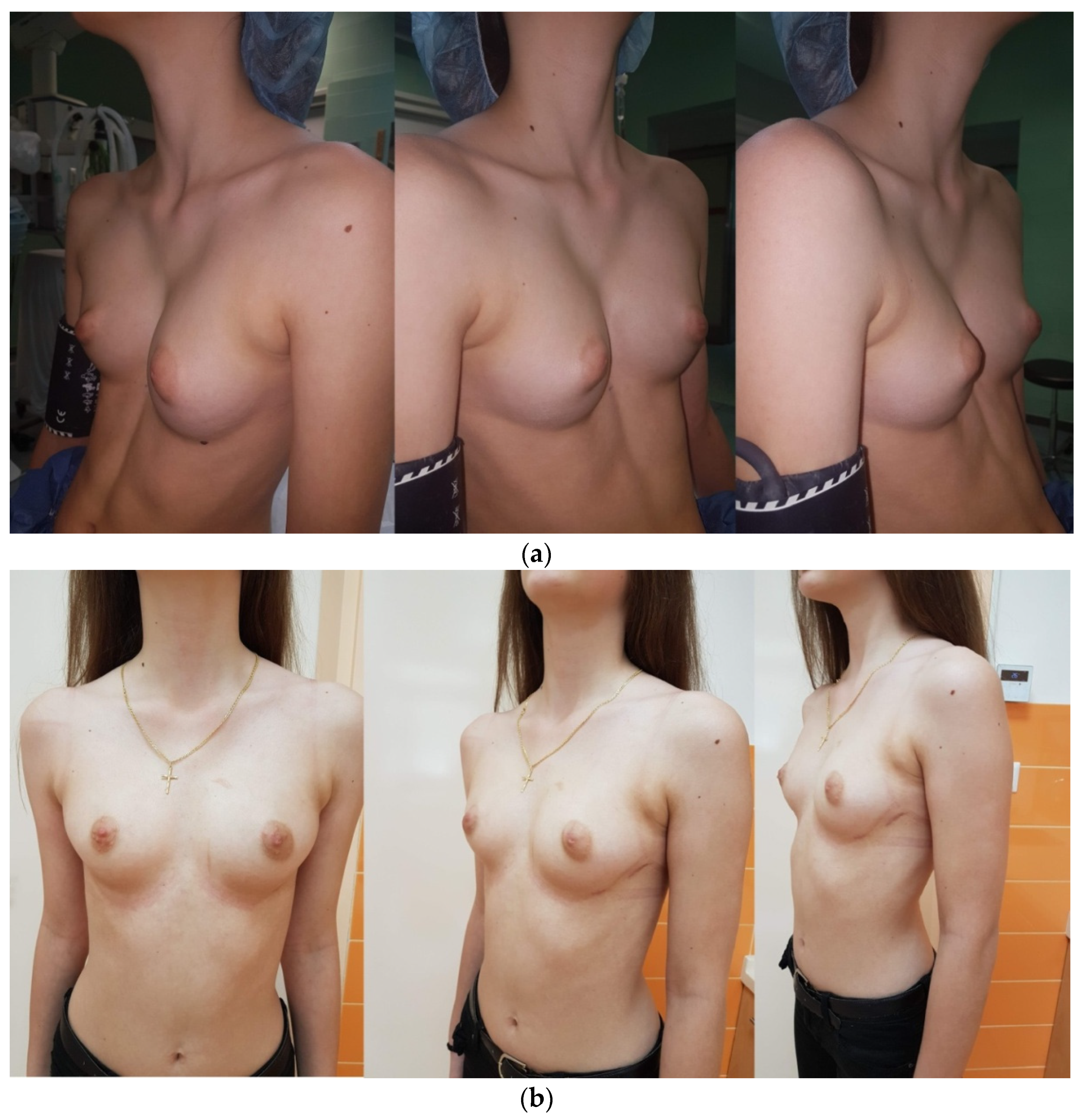 Children 08 01071 g002