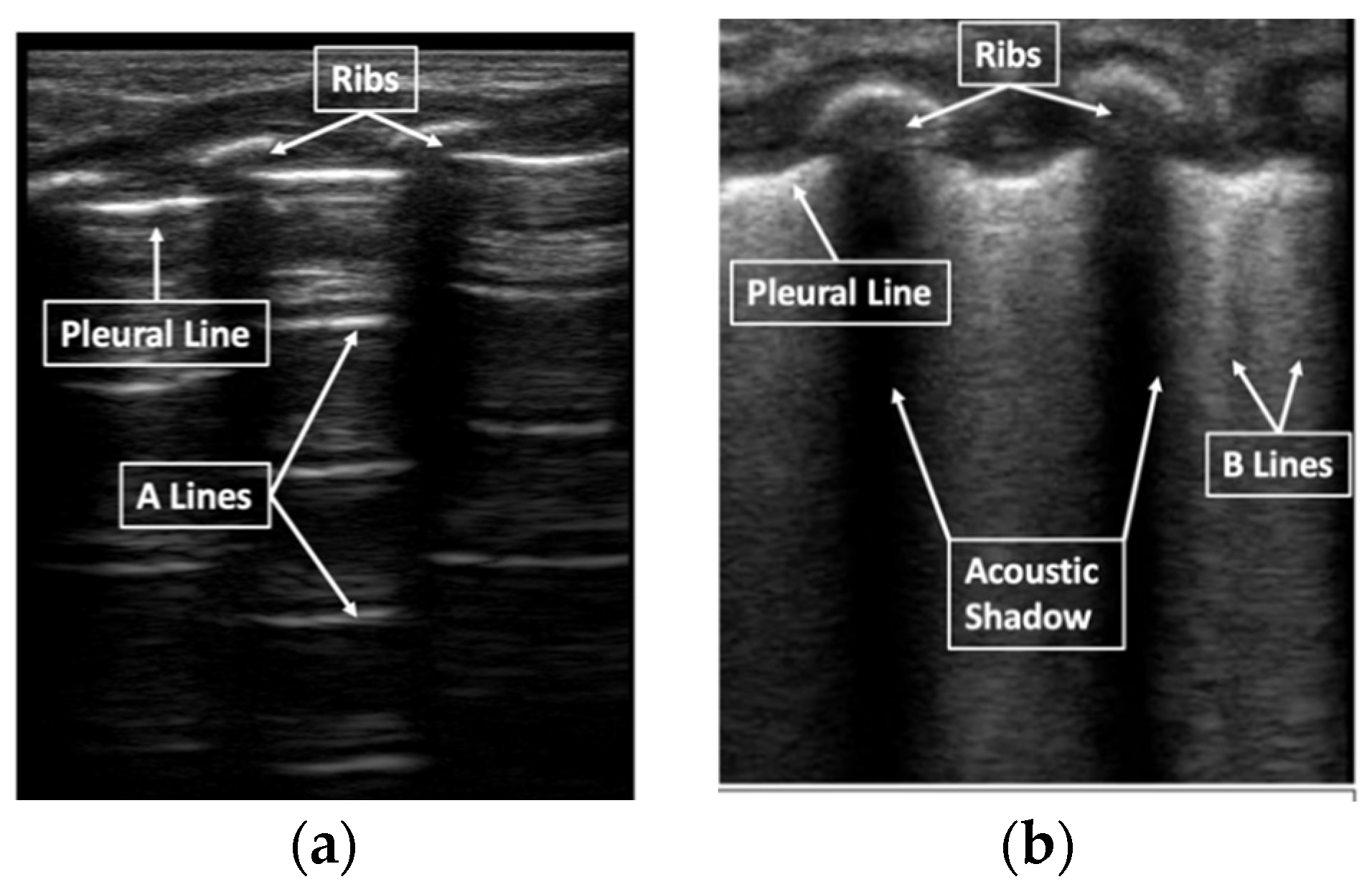Neonatal line