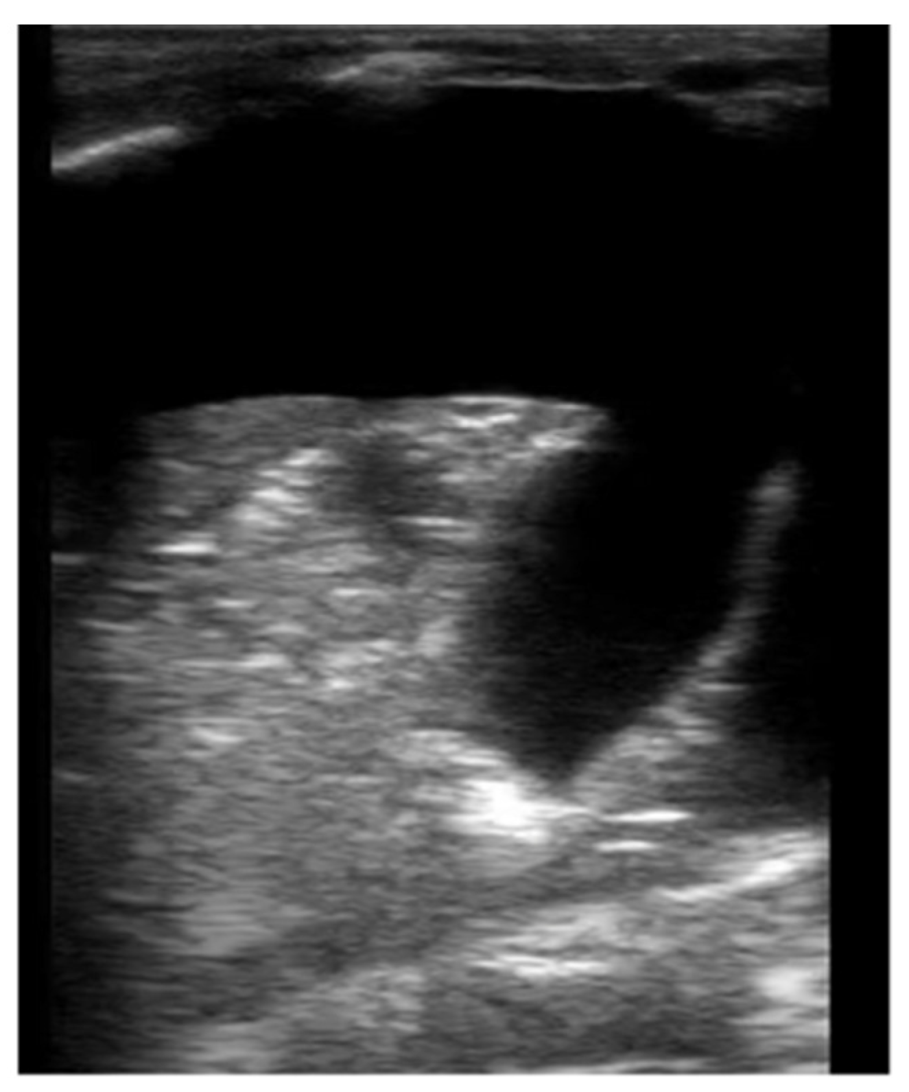 Children 08 01098 g004 550