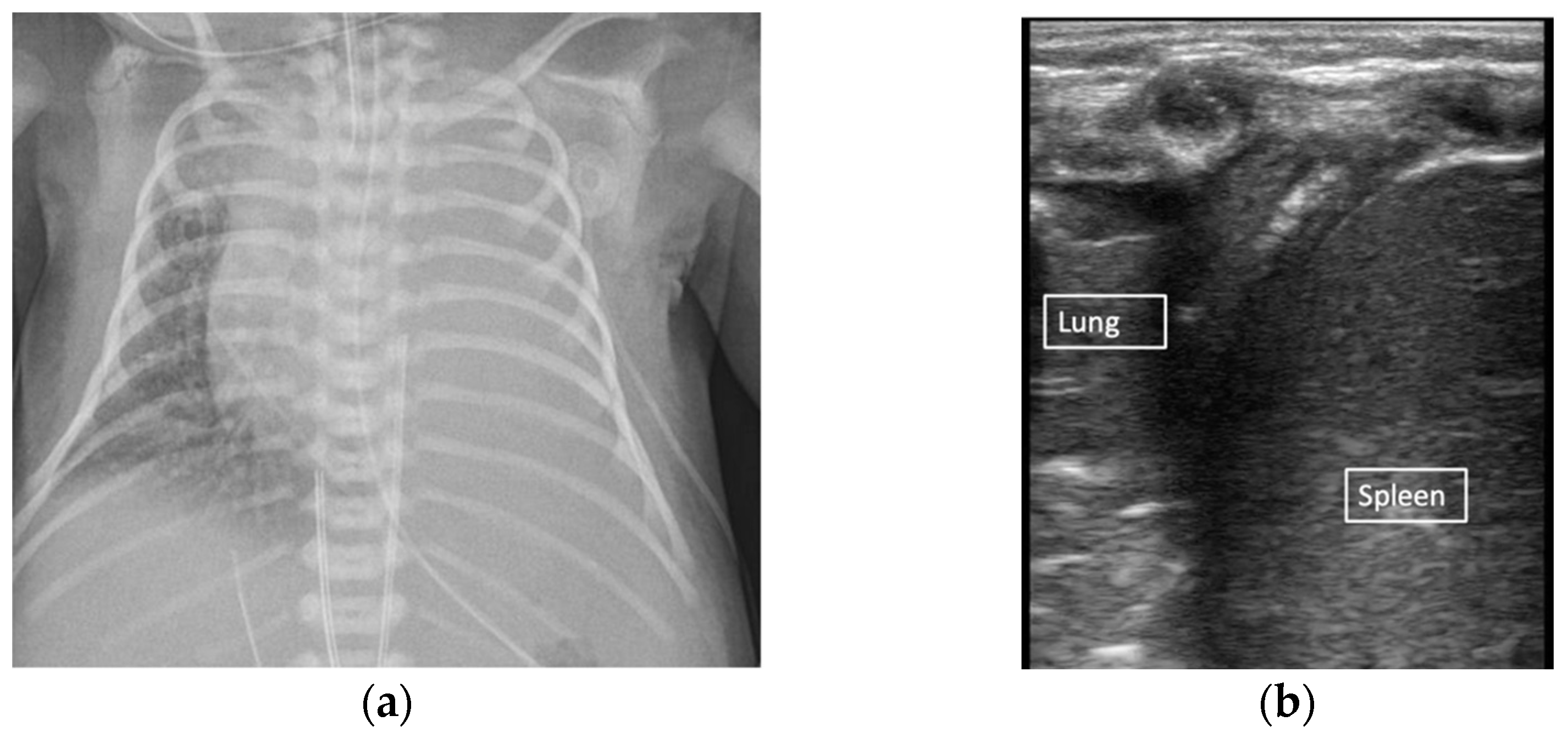 Children 08 01098 g005 550