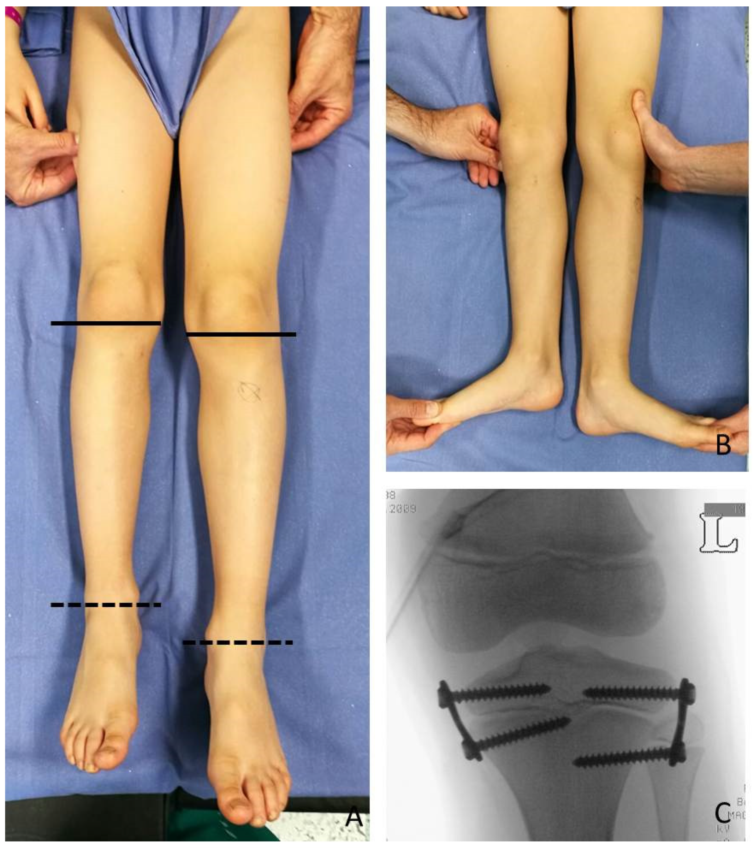 Children 08 01152 g004 550