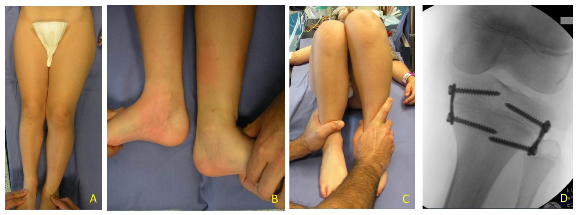 Children 08 01152 g005 550