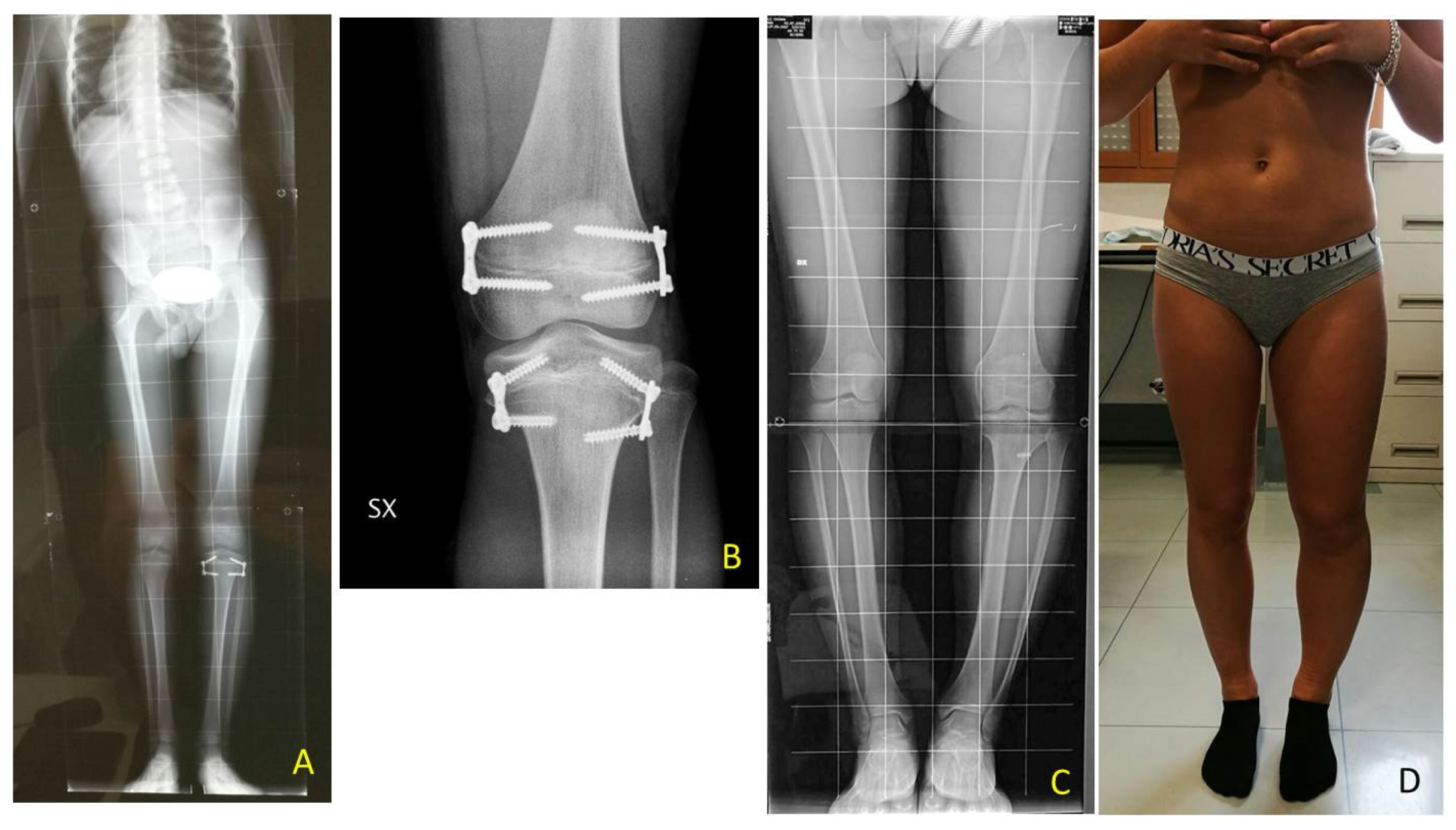 Children 08 01152 g010 550