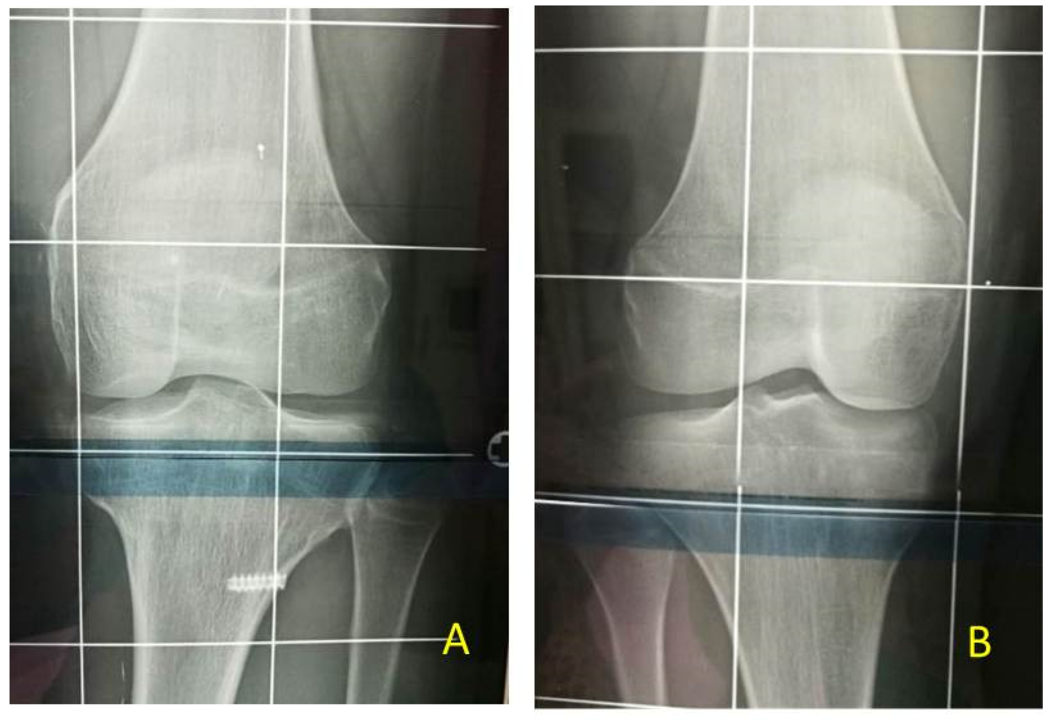 Children 08 01152 g011 550