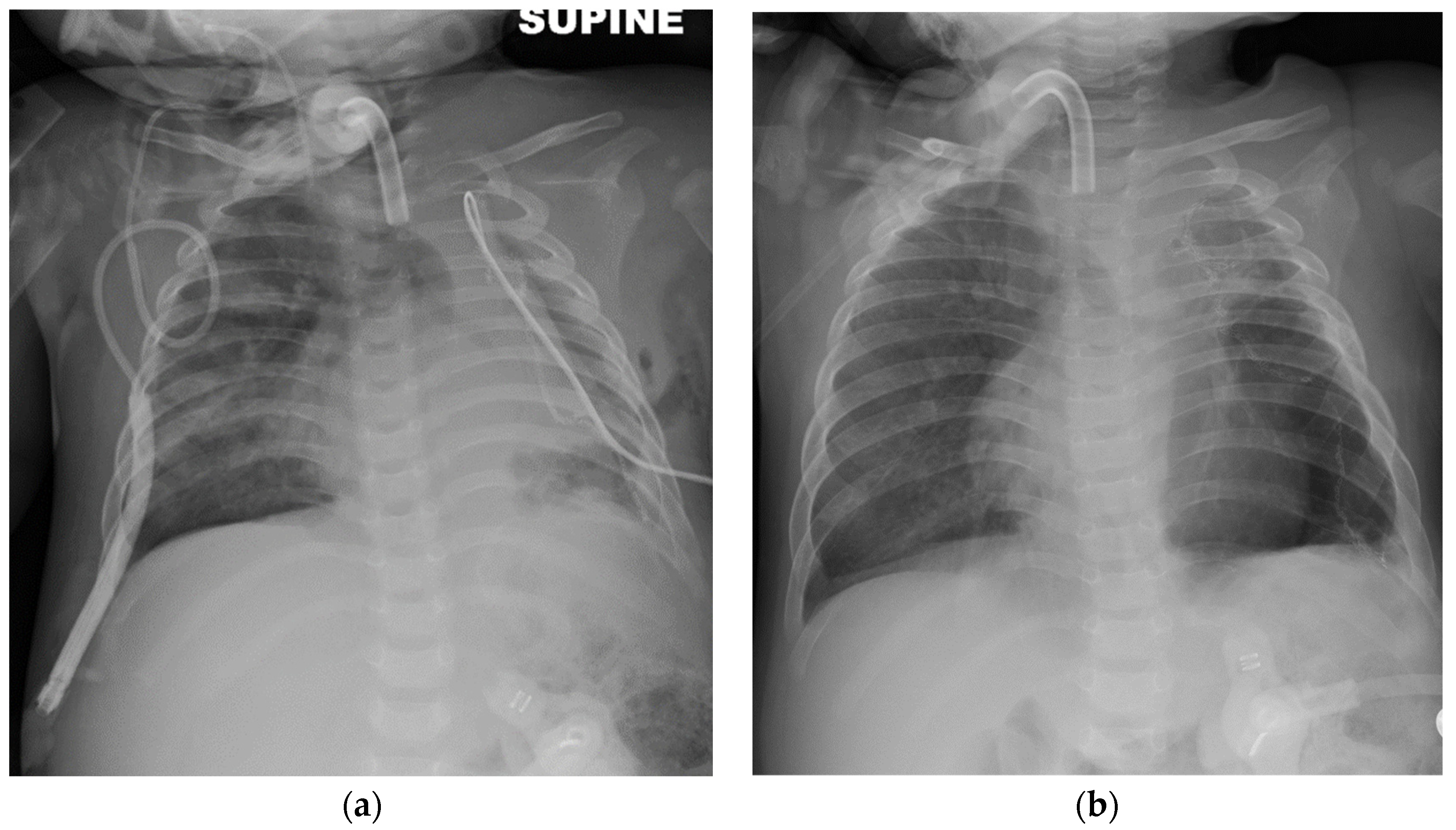 Children 08 01163 g003 550