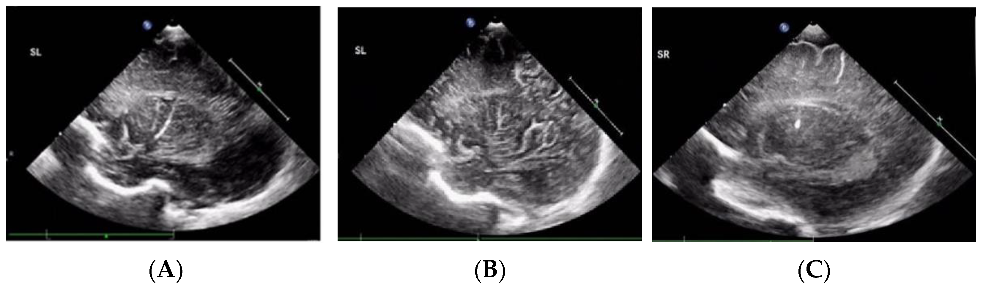 Children 08 01166 g001