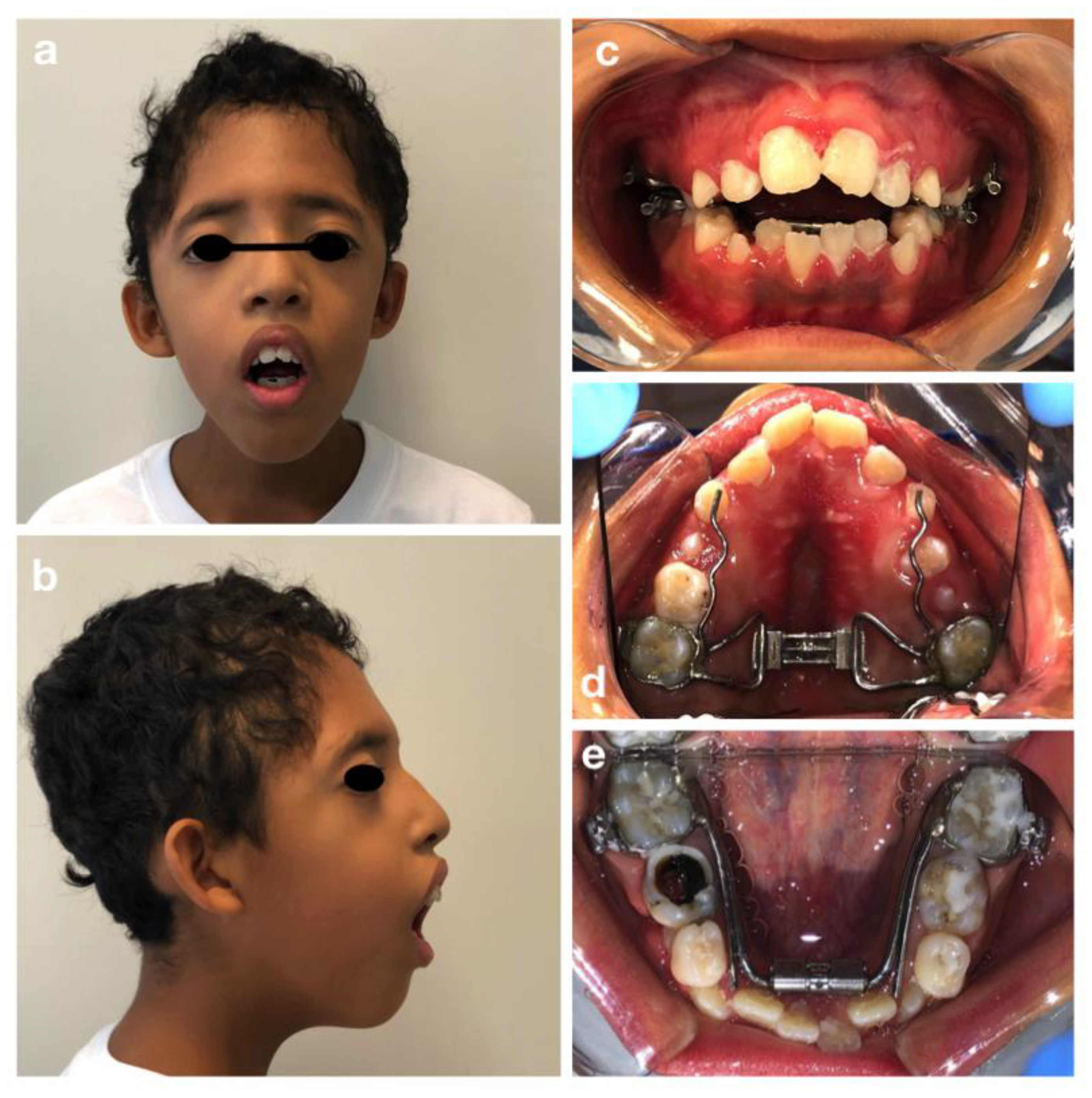 Children 09 00012 g002 Children 09 00012 g002