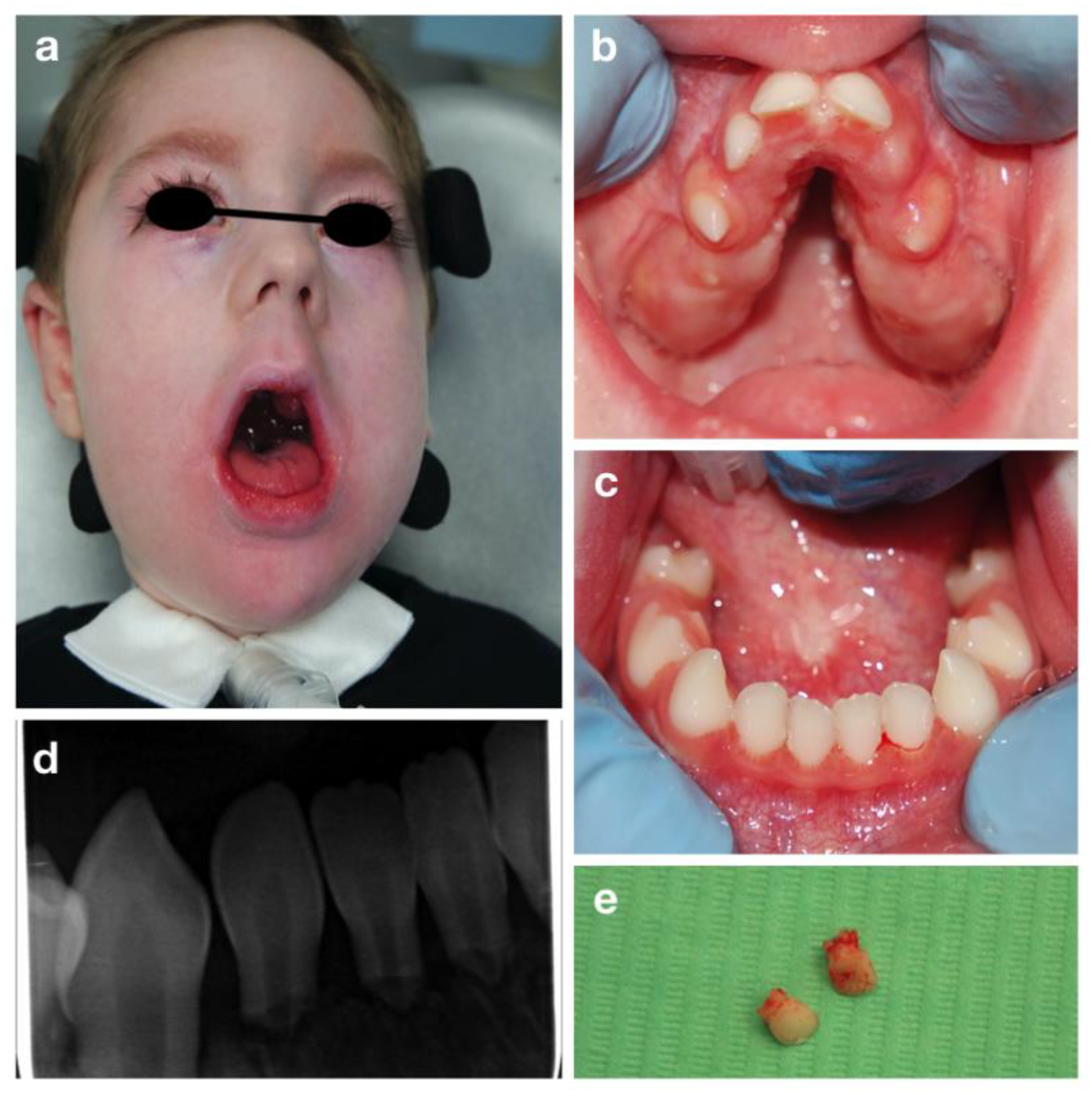 Children 09 00012 g003 Children 09 00012 g003