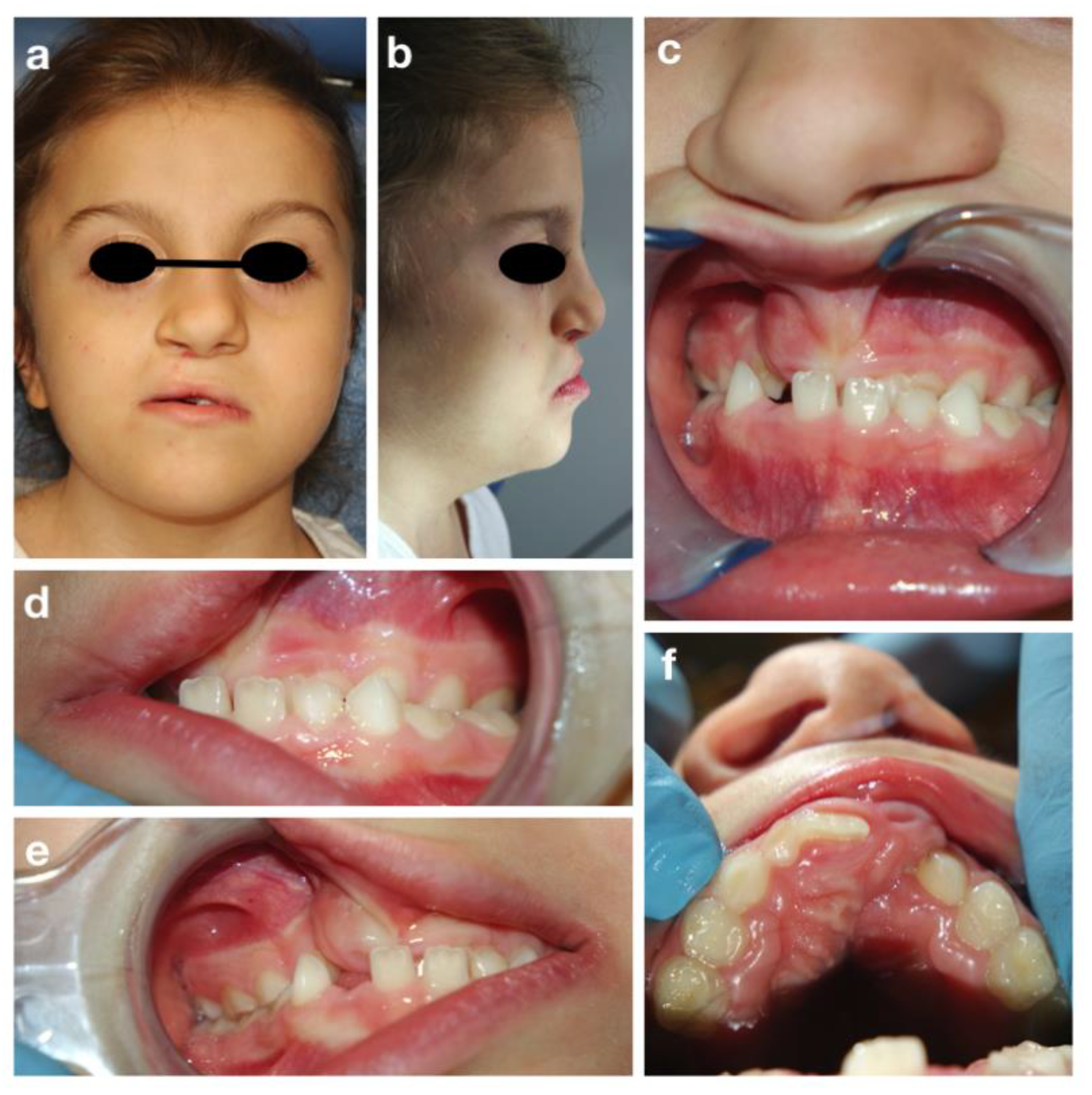 Children 09 00012 g004 Children 09 00012 g004