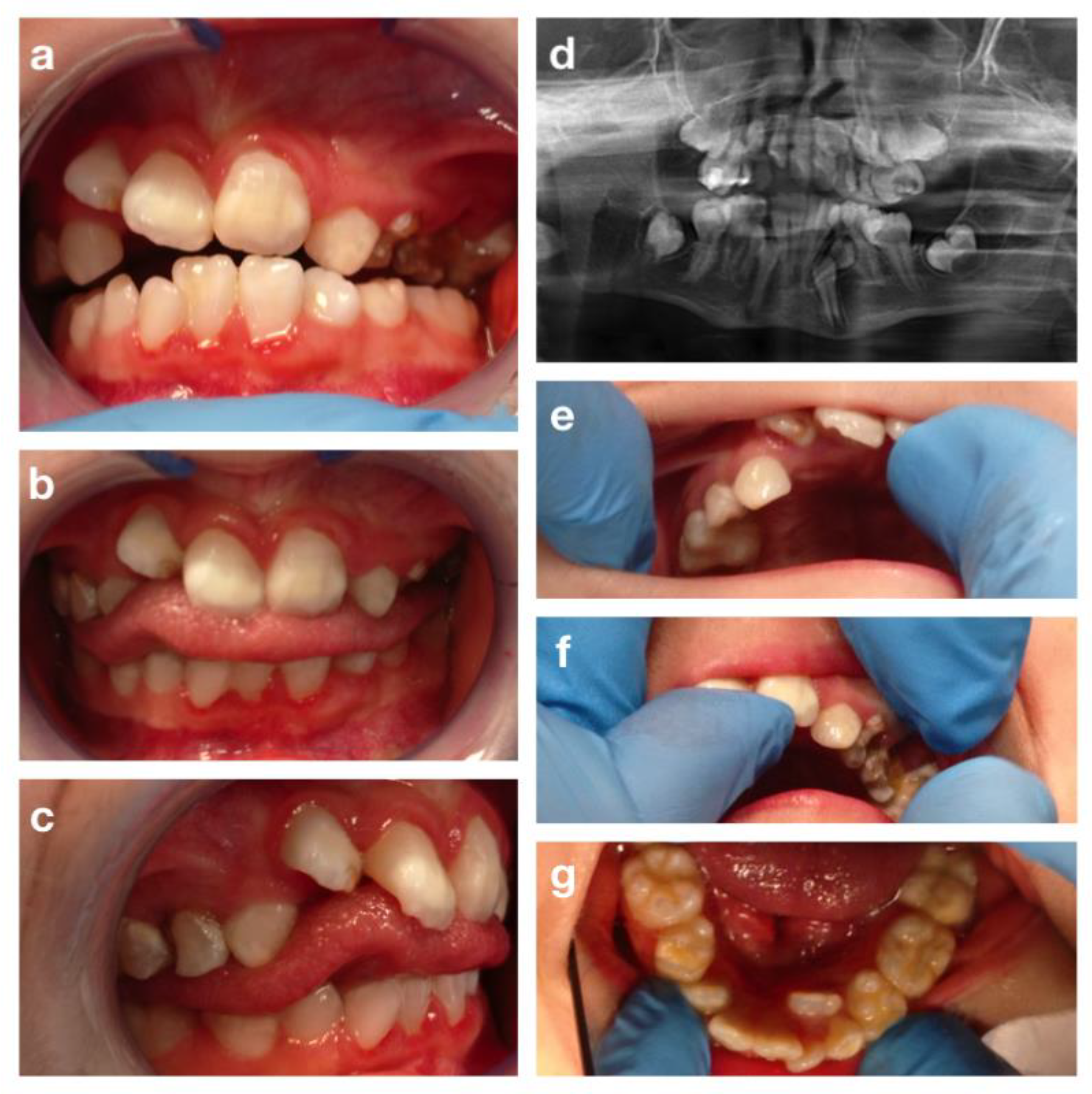 Children 09 00012 g006 Children 09 00012 g006