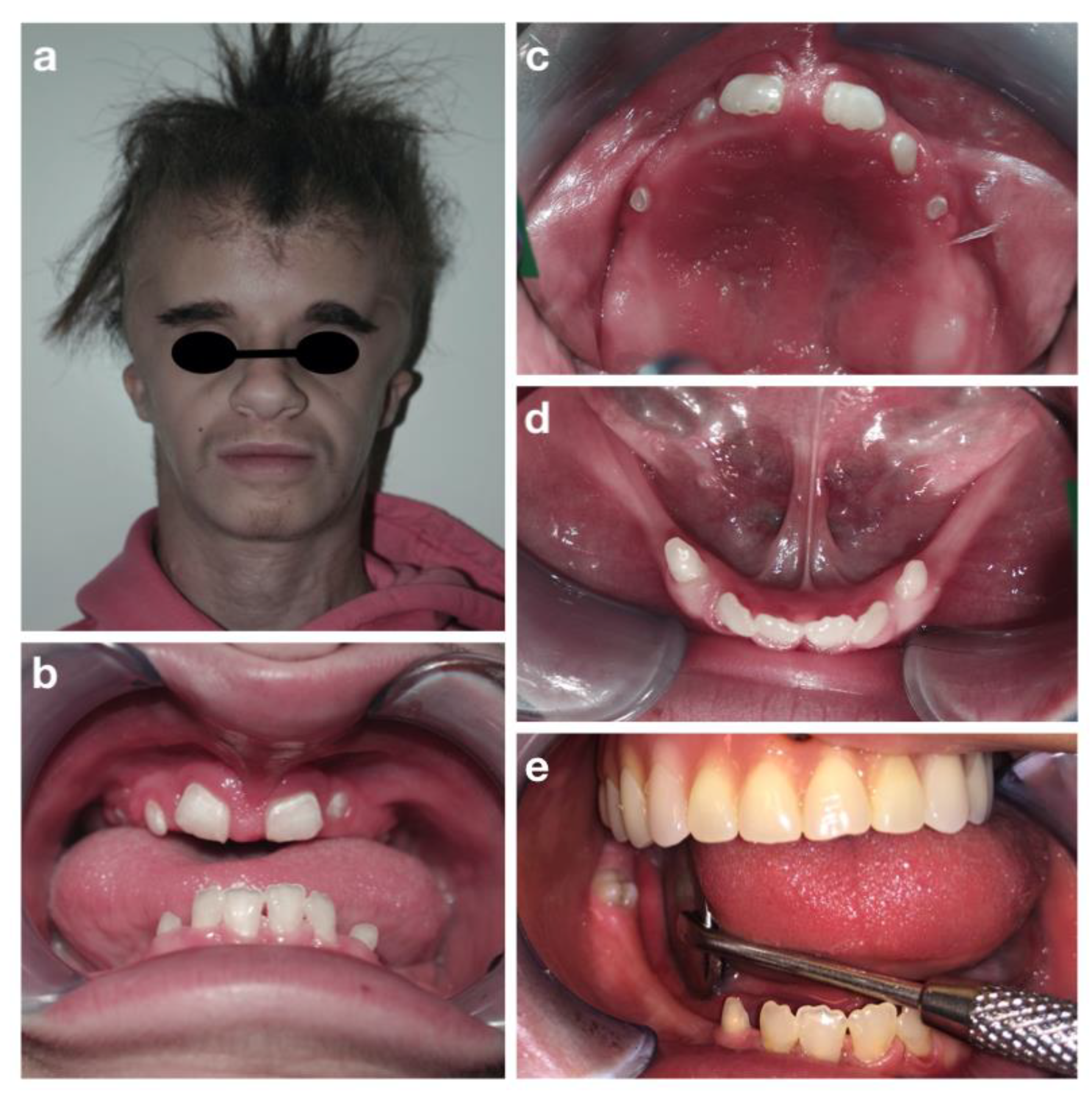 Children 09 00012 g009 Children 09 00012 g009