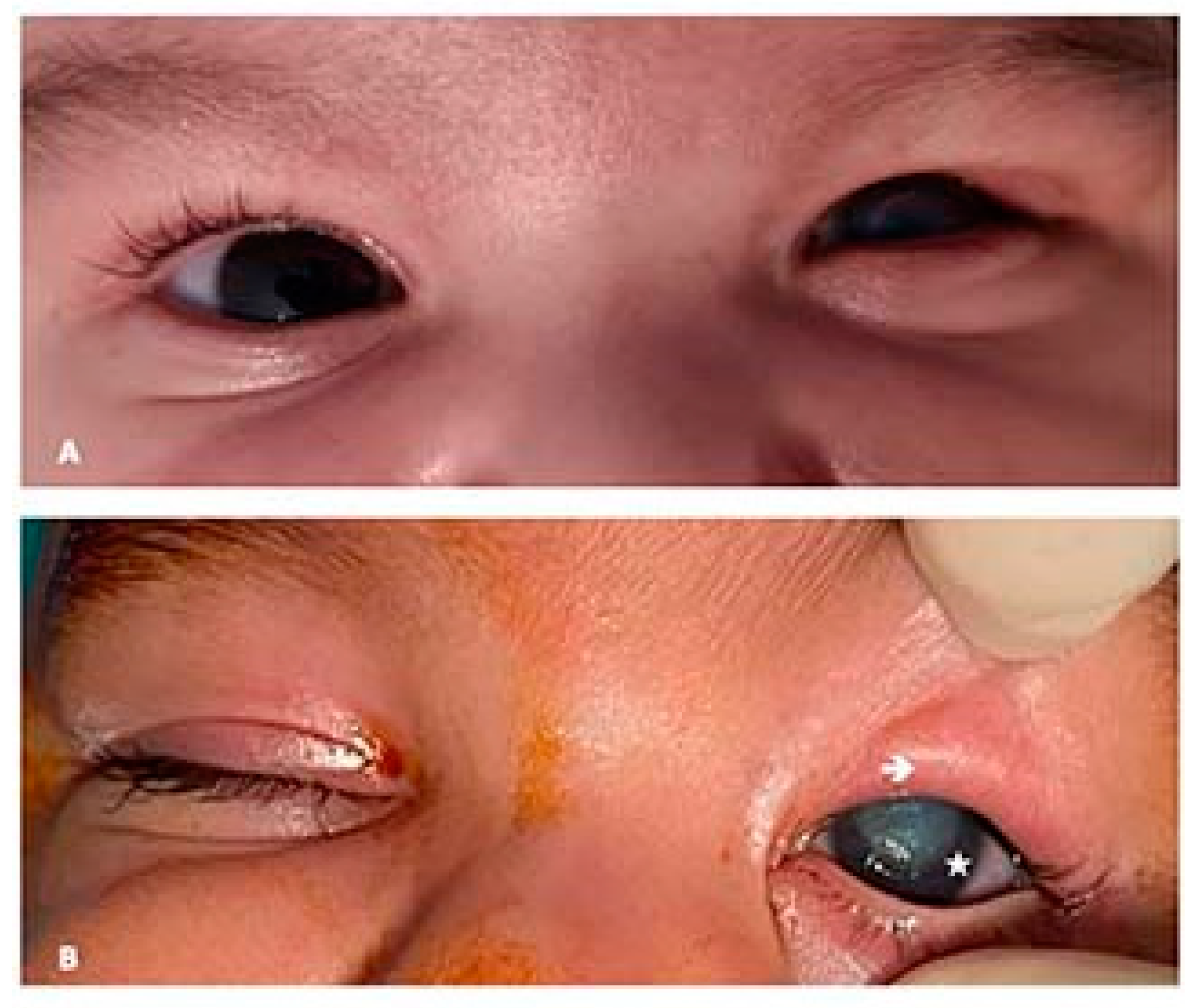 Children 09 00031 g001 550