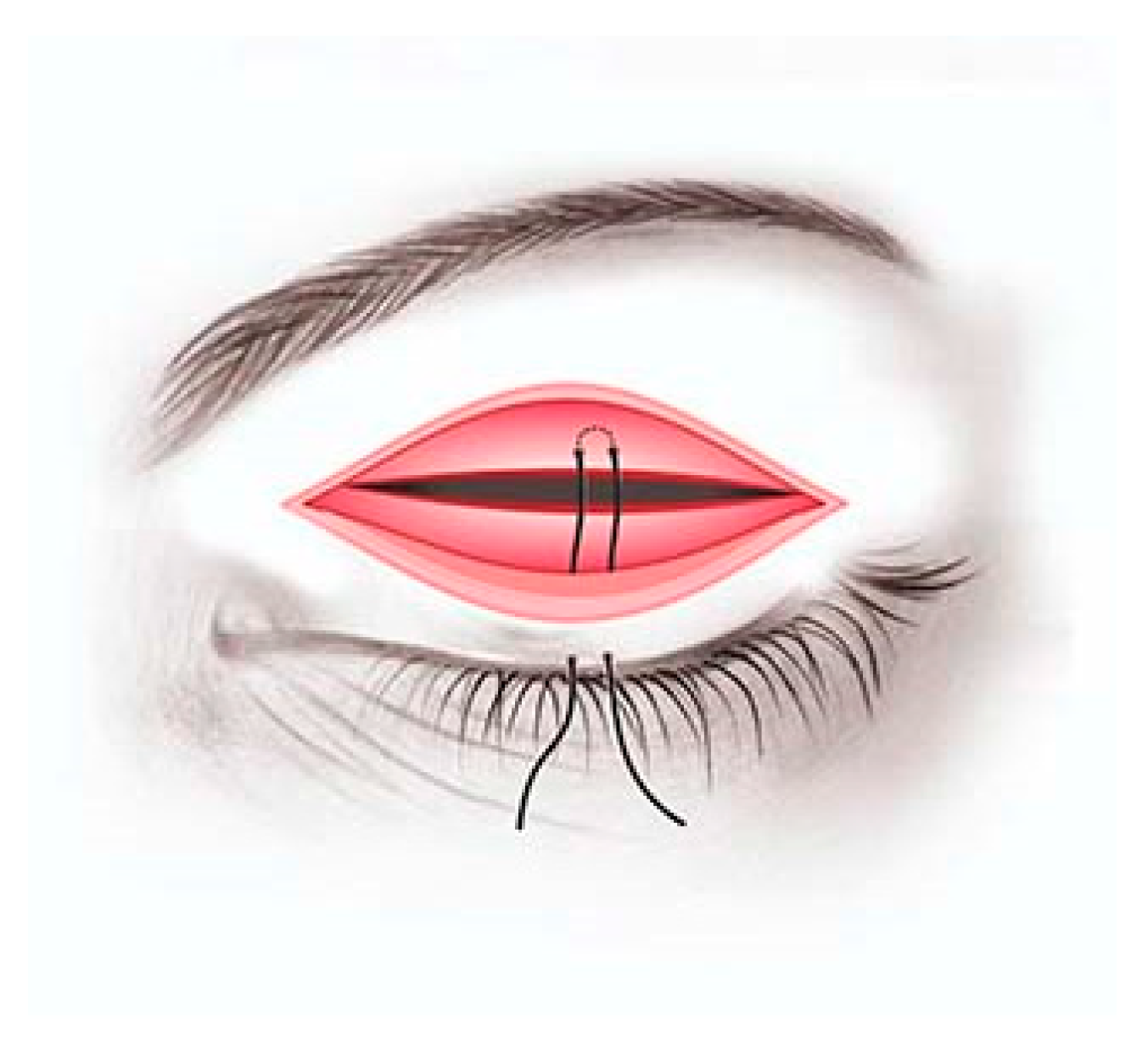 Children 09 00031 g002 550