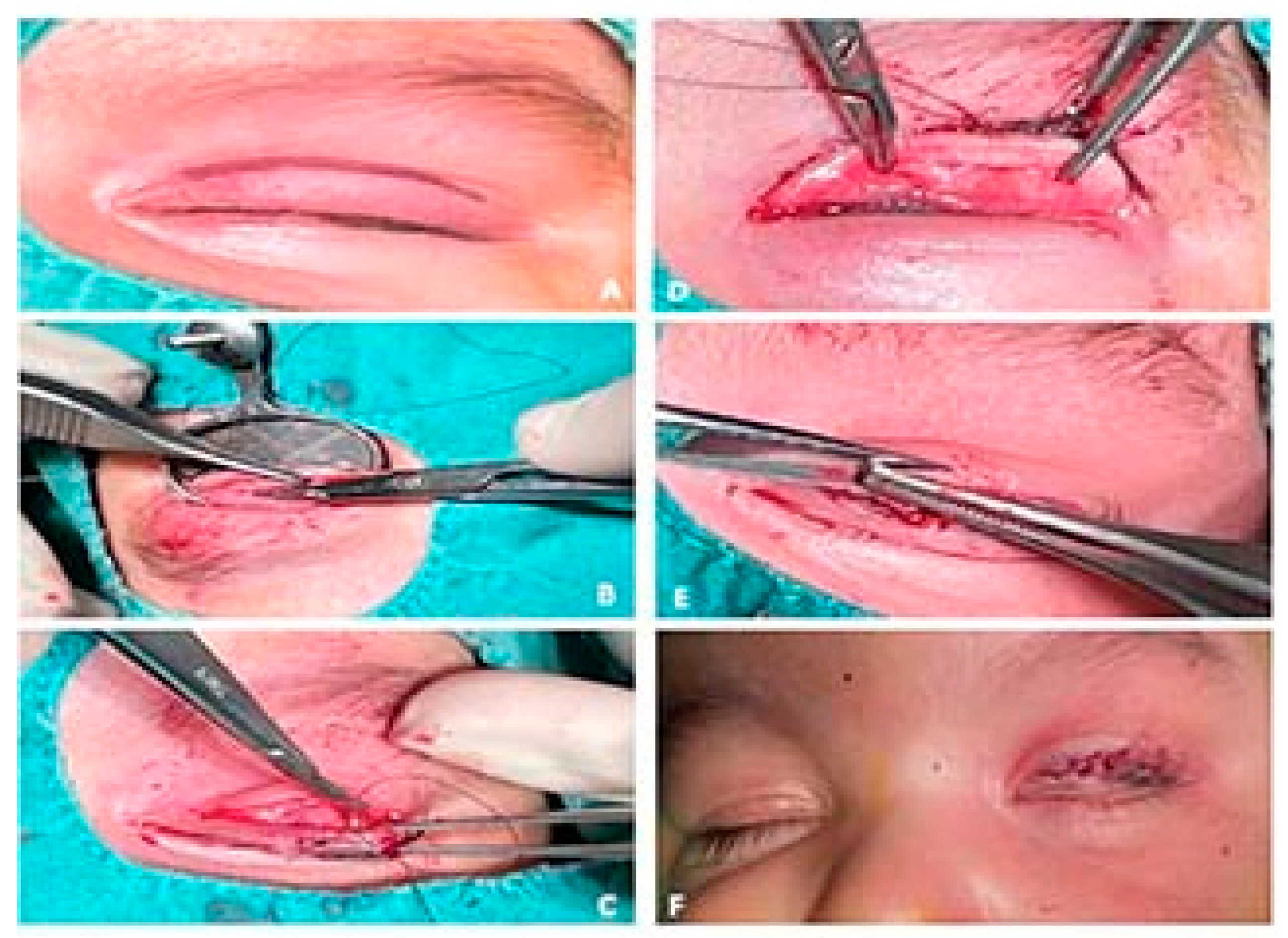 Children 09 00031 g003 550