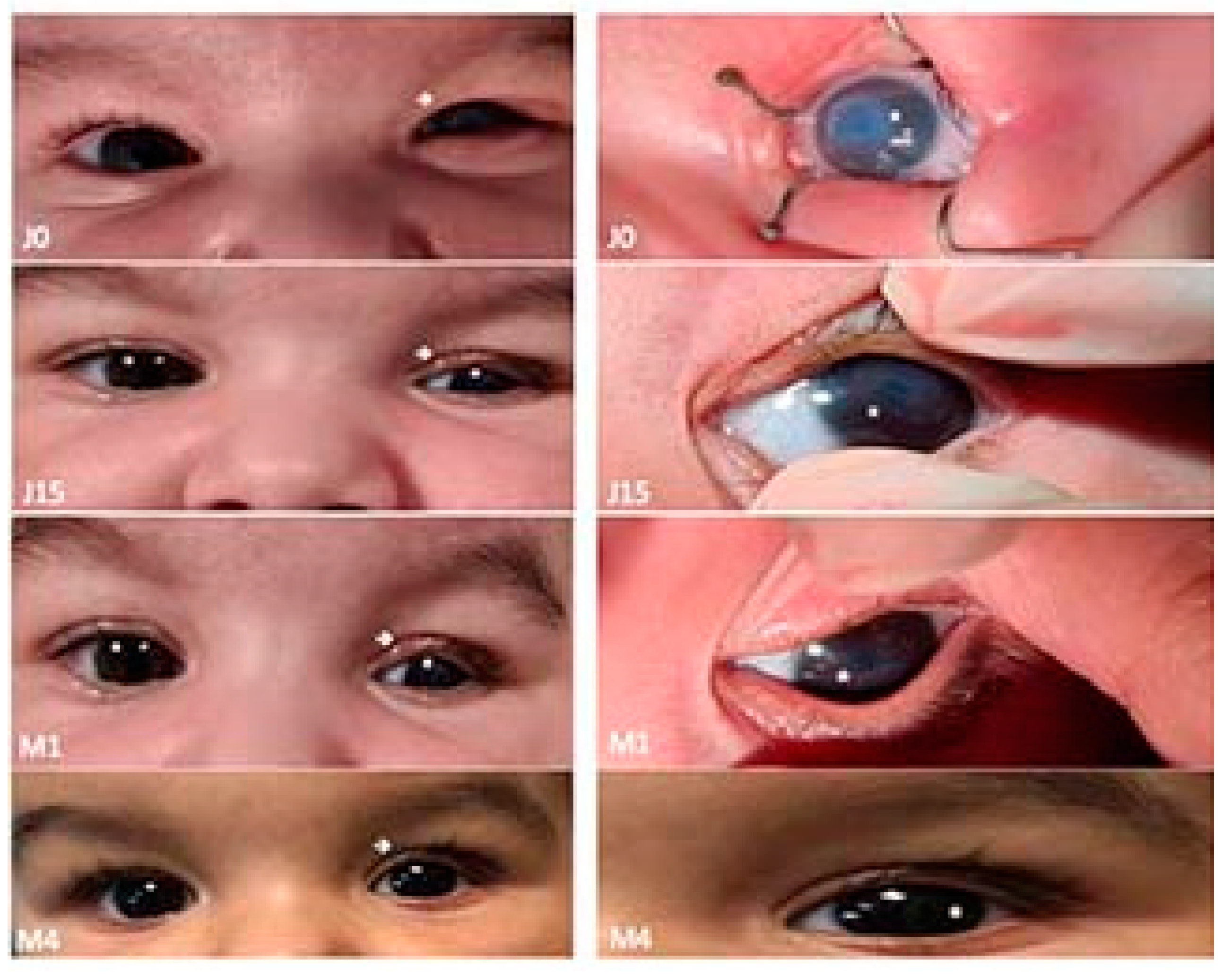 Children 09 00031 g004 550