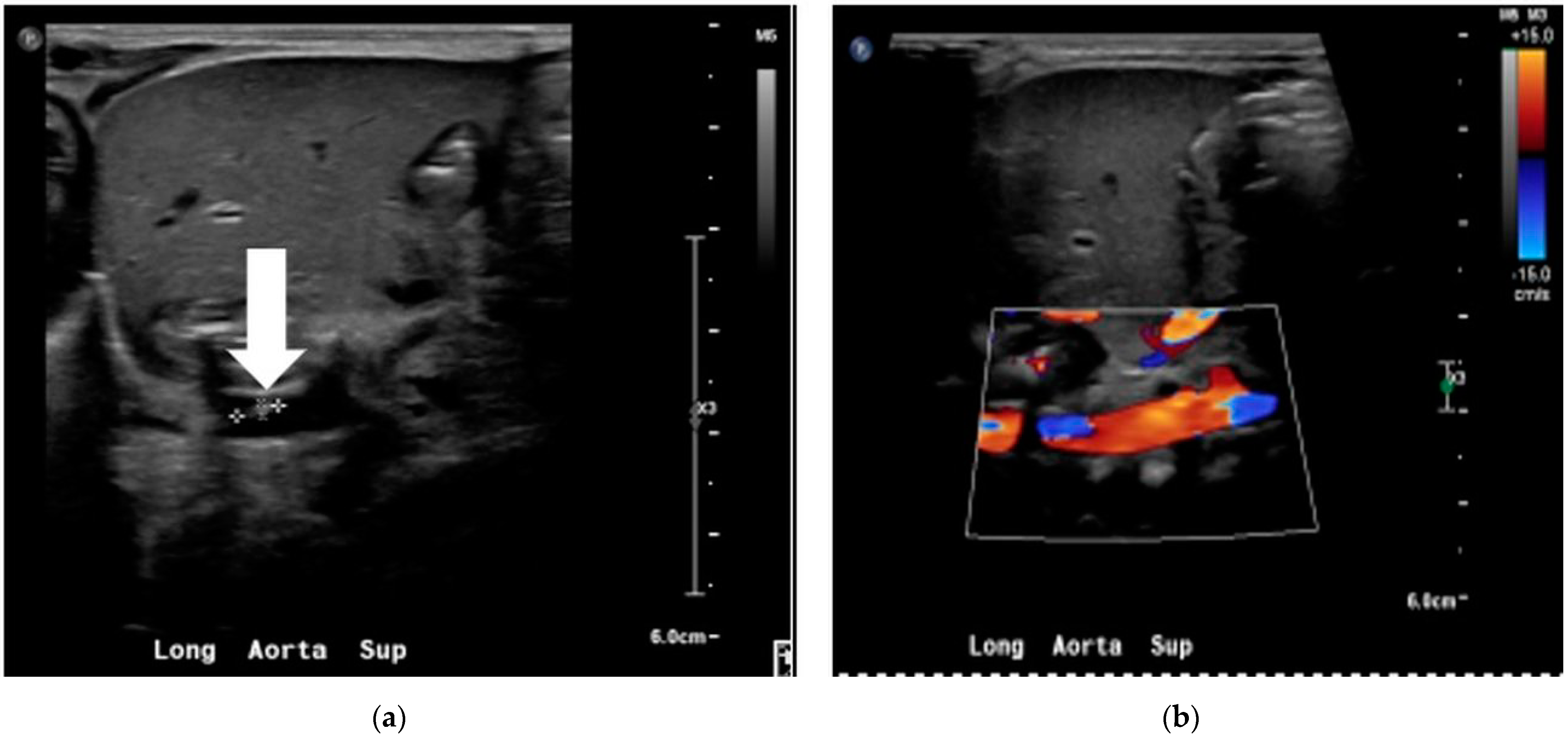 Children 09 00046 g001 Children 09 00046 g001