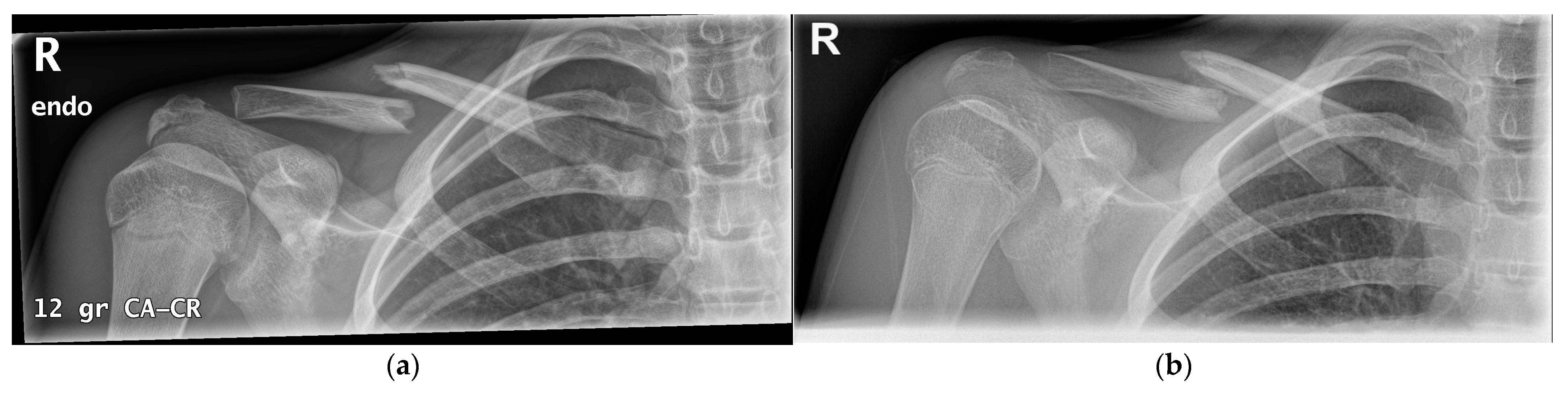 Children 09 00049 g004