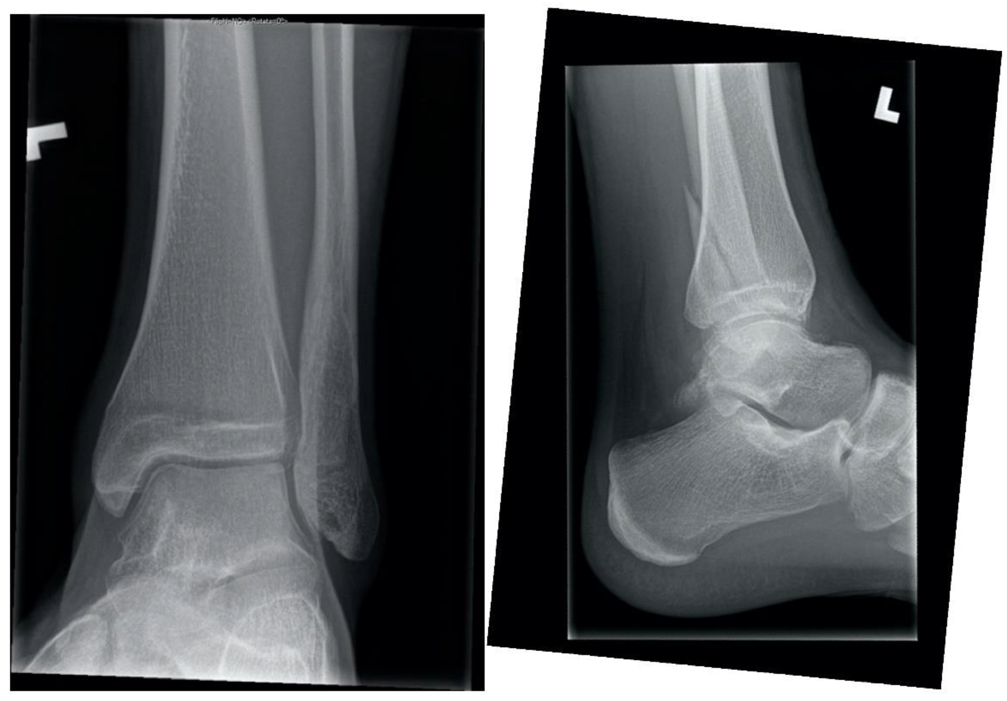 Children 09 00062 g001