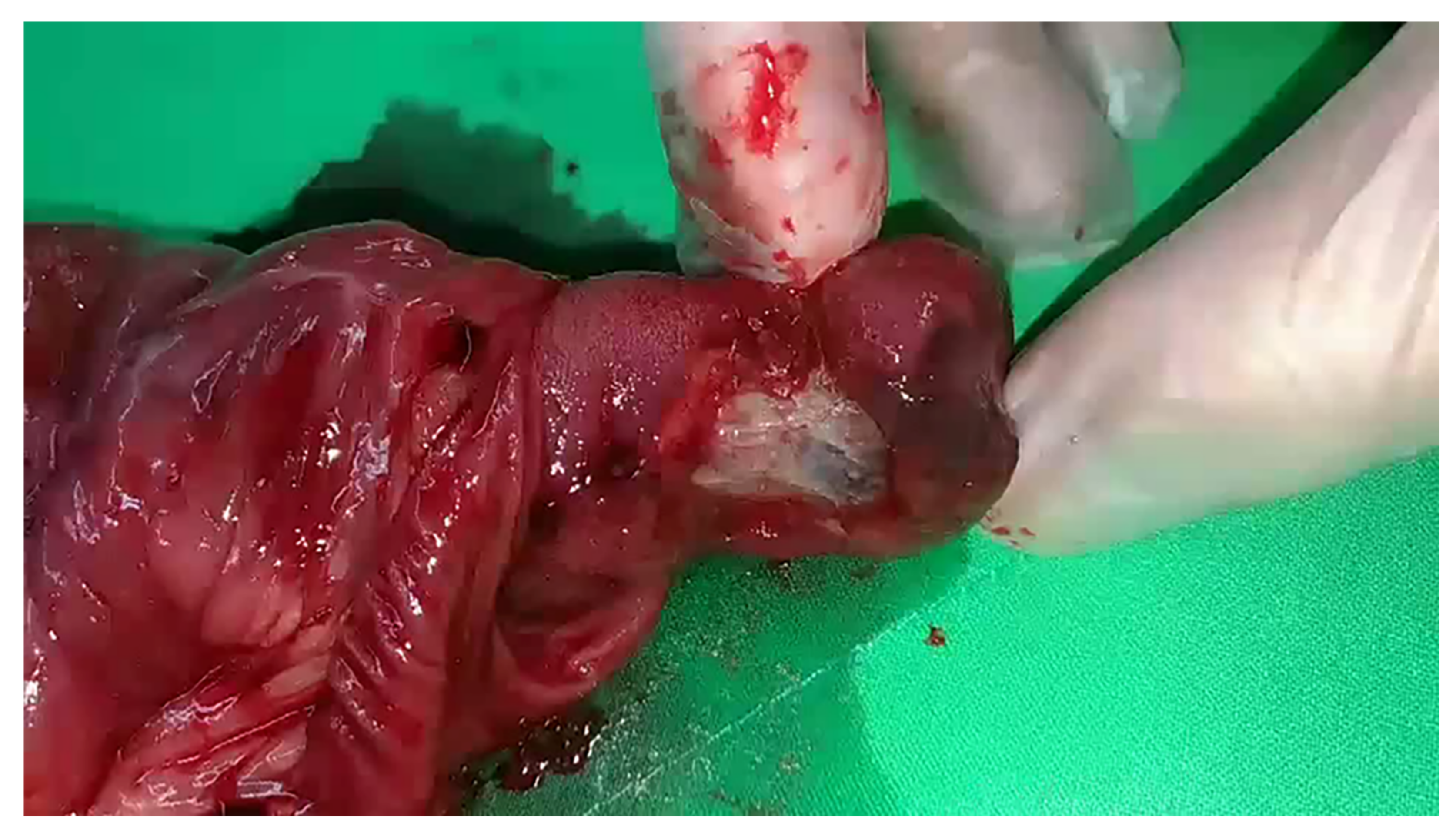 Children 09 00069 g002