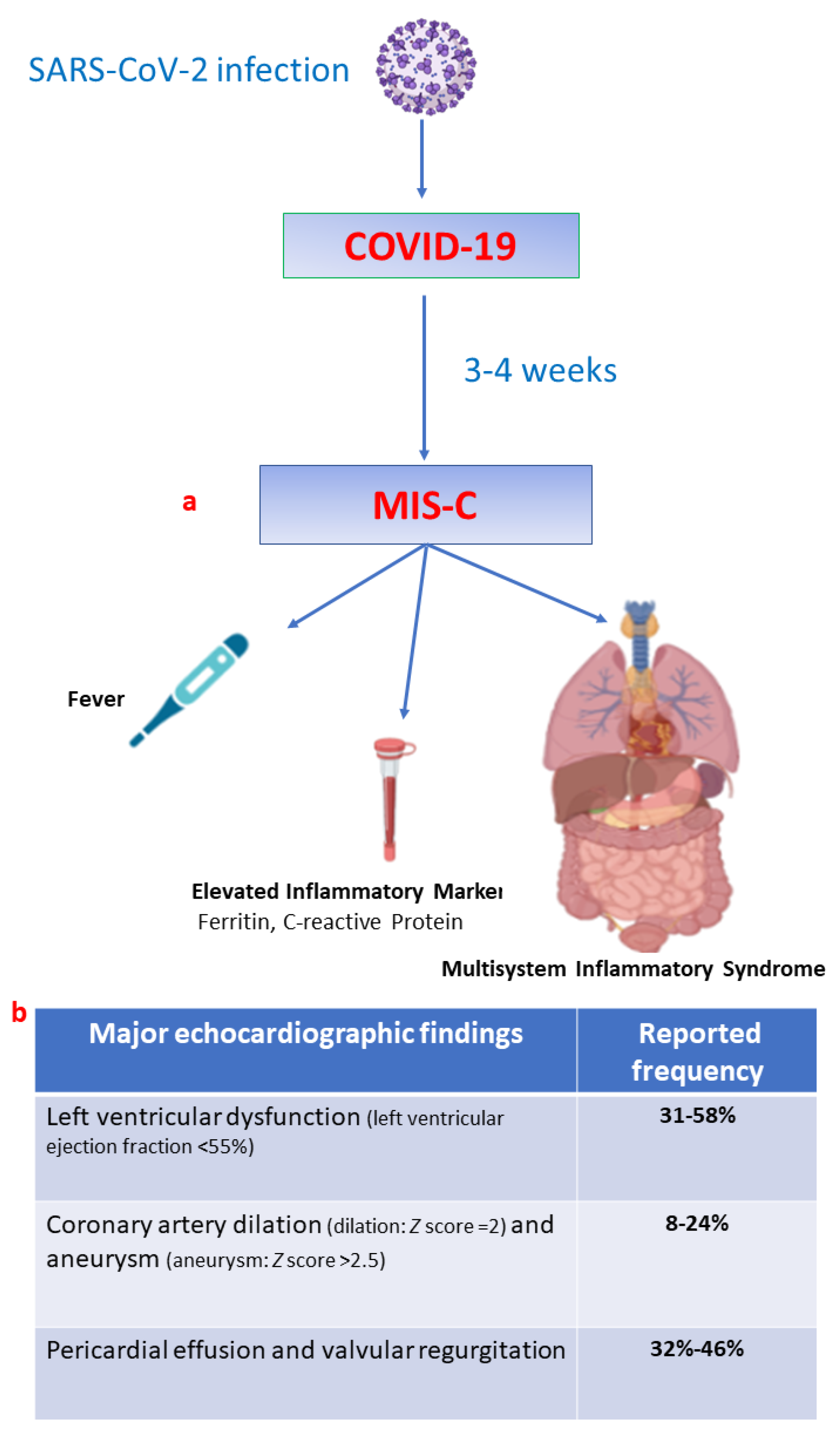 Acute Heart Failure in Multisystem Inflammatory Syndrome in